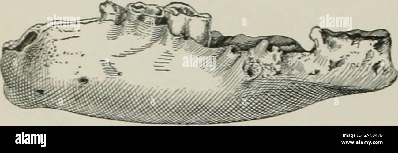 Annals of medical history . Fig. 11. Spondylitis in the lumbar vertebra ofan ancient Egyptian. About 5,000 years old. (AfterRuffer.) Fig. 12. Spondylitis deformans in a recent humanvertebra. Natural size. These four figures show the characteristic lesions of this osteoarthritis at different periods of the historyof animals and man. So far as external appearances go there has been no change in the pathological pro-cesses producing these lesions since the Pleistocene at least. Similar lesions of greater antiquity have notyet been seen. 386 Annals of Medical History is, from the geological standp Stock Photo