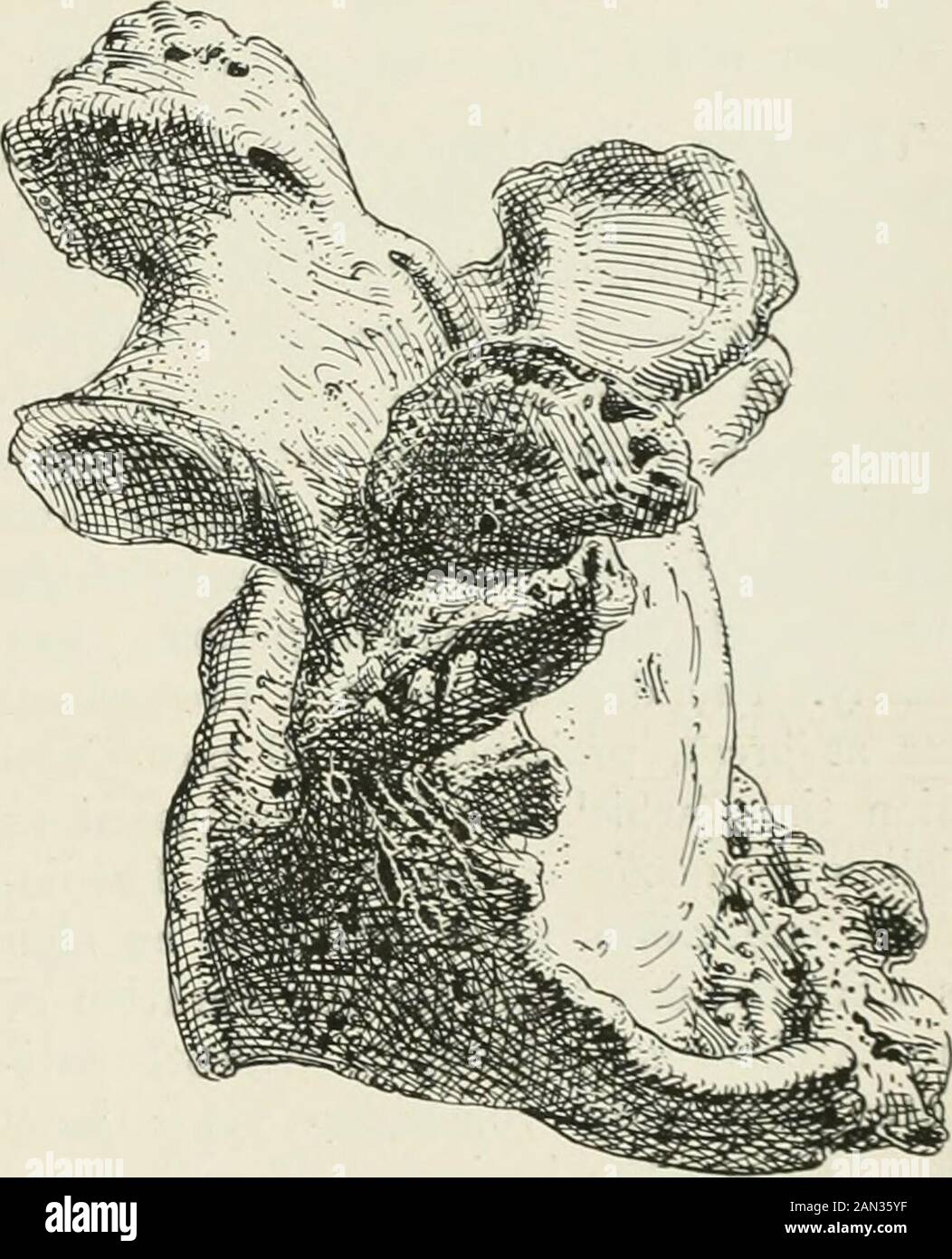Annals of medical history . Fig. 11. Spondylitis in the lumbar vertebra ofan ancient Egyptian. About 5,000 years old. (AfterRuffer.) Fig. 12. Spondylitis deformans in a recent humanvertebra. Natural size. These four figures show the characteristic lesions of this osteoarthritis at different periods of the historyof animals and man. So far as external appearances go there has been no change in the pathological pro-cesses producing these lesions since the Pleistocene at least. Similar lesions of greater antiquity have notyet been seen. 386 Annals of Medical History is, from the geological standp Stock Photo