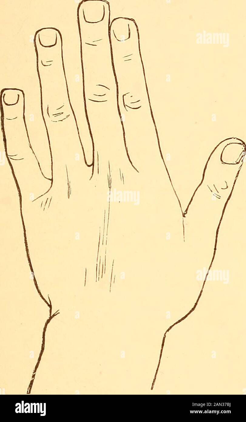 Hand Concise Concise exposition hi-res stock photography and images - Alamy