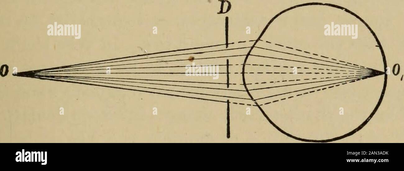 Textbook of ophthalmology . monocular diplopia persists, although but