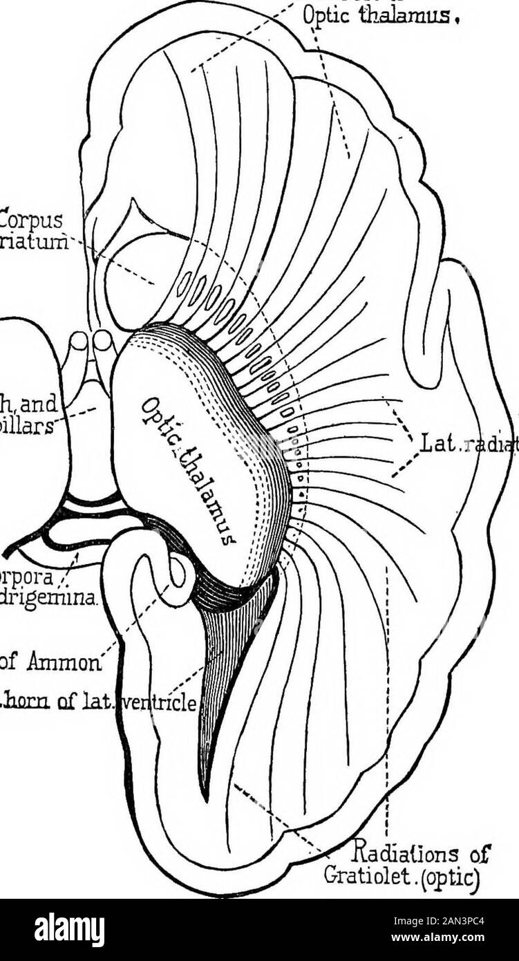 Lecture Digression Lectures on localization in diseases of the brain, delivered at the ...