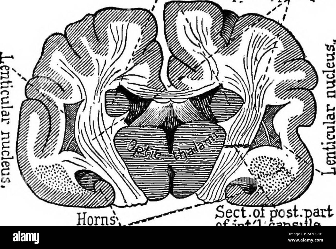 Lectures on localization in diseases of the brain, delivered at the Faculté de médecine, Paris, 1875 . ysis), on thecontrary, occurs unaccompanied with anaesthesia wheneverthe lesion is confined to any point of the anterior two-thirds,leaving the posterior third of the internal capsule untouched.(Figs. 27 and 28.) Such in brief are the substantial results of these experiments. After the foregoing, you will see that everything concurs toestablish the existence of direct fascicuH of centripetal nerve-fibres in the posterior part of the internal capsule, having forfunction the conduction of sen Stock Photo