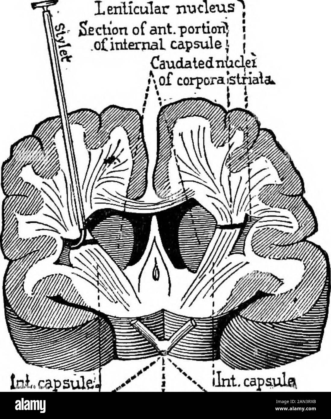 Lectures on localization in diseases of the brain, delivered at the Faculté de médecine, Paris, 1875 . !• .oCinlemal capsule j | ^Caudatedniclei* of corporastriali. IzA-capsulei (Tiiasma of optic nerves^ Fig. 27.—-Transverse section of a dogsbrain, five millimetres anterior to the opticchiasma. that assertion, in showingthat a lesion situated abovethose points, in certain re-gions of the brain itself, wasquite sufficient to invariablyproduce a total hemianses-thesia. Recent experimentalresearches made by Duretand Veyssi^re, in the lab.or-atory of Vulpian, have givenresults also in conformity Stock Photo