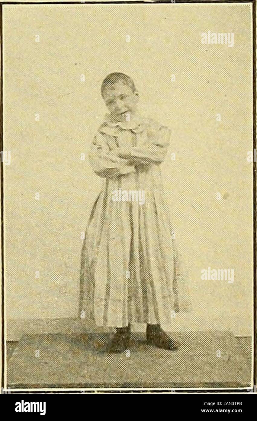 Types of mental defectives . Case C.. Case D. Case E.Mongolians. Case F. 143 EPILEPIICS 145 CASE E.—Mongolian Type (Low-Grade). M. F. was 10 years old when photo was taken. A typical mon-gohan, with tawny, leathery complexion, Chinese cast of countenance,coarse, black hair, deep voice, and stumpy fingers. The father, awheelwright, was 50 and the mother 49 at the time of this childsbirth. Just before Ms birth, the father had pneumonia, which affectedhis brain, and he became incurably insane. The mother, who isfeeble-minded, with a deep, guttural voice, suffered much mentally andphysically durin Stock Photo