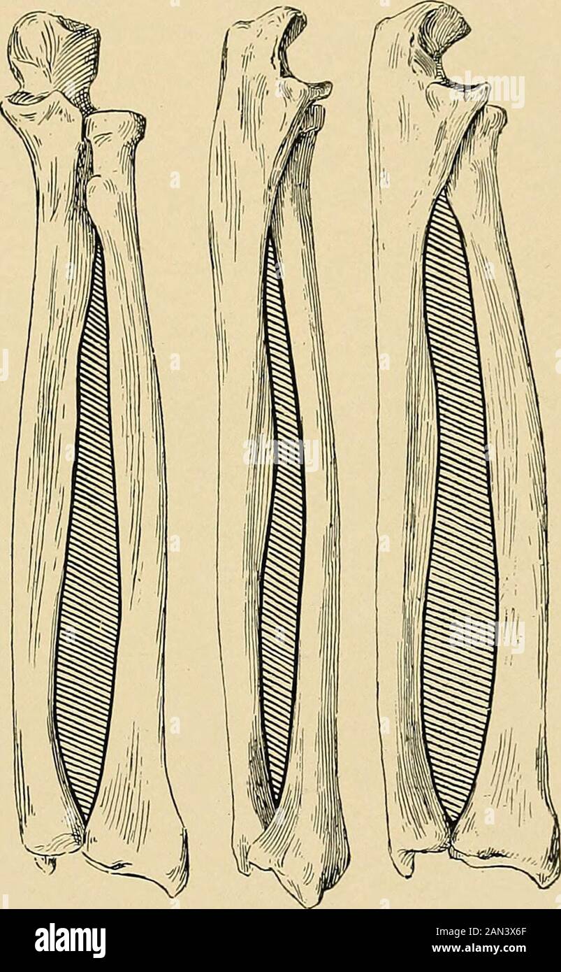 The treatment of fractures . should beone-fourth of an inch wider than ...