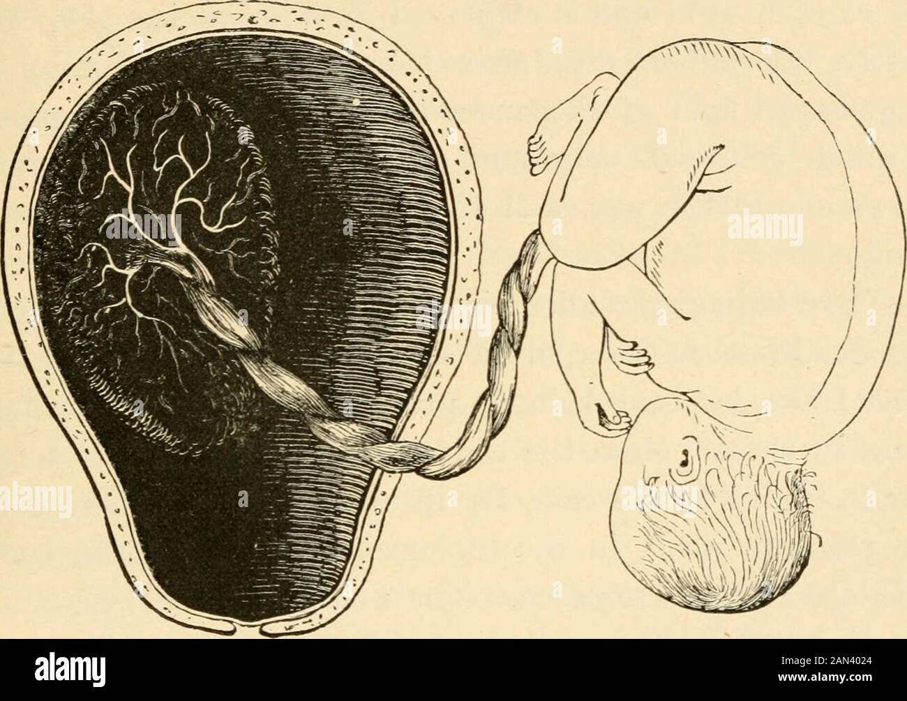 The evolution of man: a popular exposition of the principal points of human ontogeny and phylogenyFrom the German of Ernst Haeckel . Fig. 200.—Human embryo, twelve weeks old, with its coverinjrs; naturalsize. The navel cord passes from the navel to the placenta: 6, amnion;c, chorion; d, placenta; c?, remains of tufts on the smooth chorion;/, dc-cidua refiexa (inner); g, decidua vera (outer). (After Bernbard Schultze.) latter is not attached to the placenta. The placental orspongy deciduous membrane {d. placentcdis or serotina,Fig. 198,j9Z?^5 Fig. 200, d) is simply the maternal placenta THE DEC Stock Photo