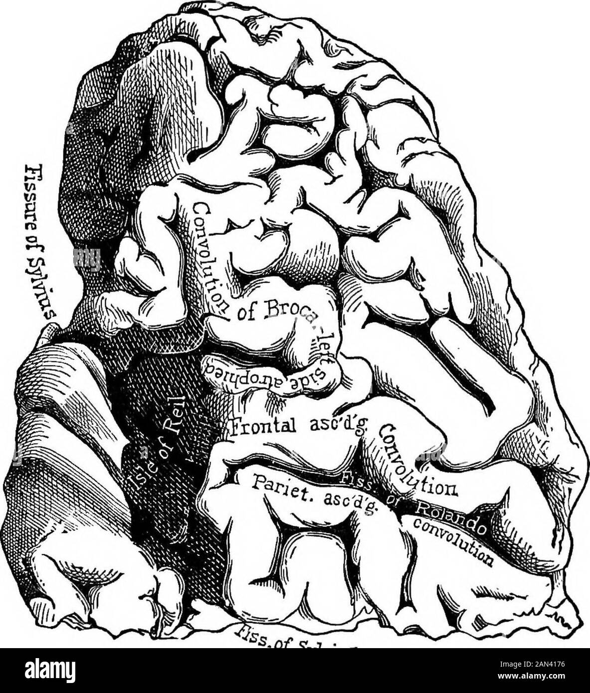 Lectures on localization in diseases of the brain, delivered at the Faculté de médecine, Paris, 1875 . Fig. 12.—Vascular territories of the superior cerebral surface. (Daret.) Thedotted lines indicate the territories of the anterior, middle and posterior arteries. territory of the third convolution (in its posterior part). Ihere add a conclusively corroborative fact. The case wasa woman named Farn.... observed at Salpetriere. She wasattacked with aphasia. There had existed no trace of paral-ysis either of motion or sensation. Aphasia was in this case 54 DISEASES OF THE BRAIN. the only sympto Stock Photo