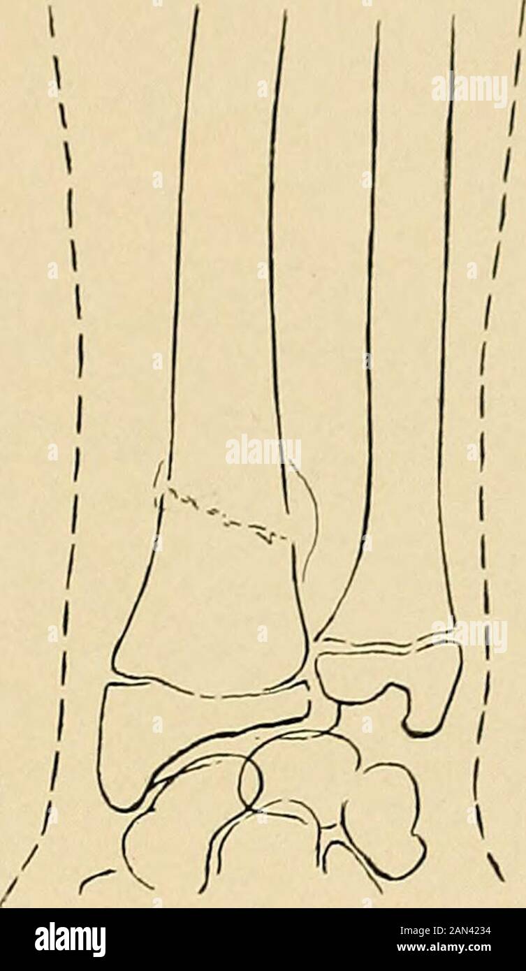 Pronation-supination movement angle.