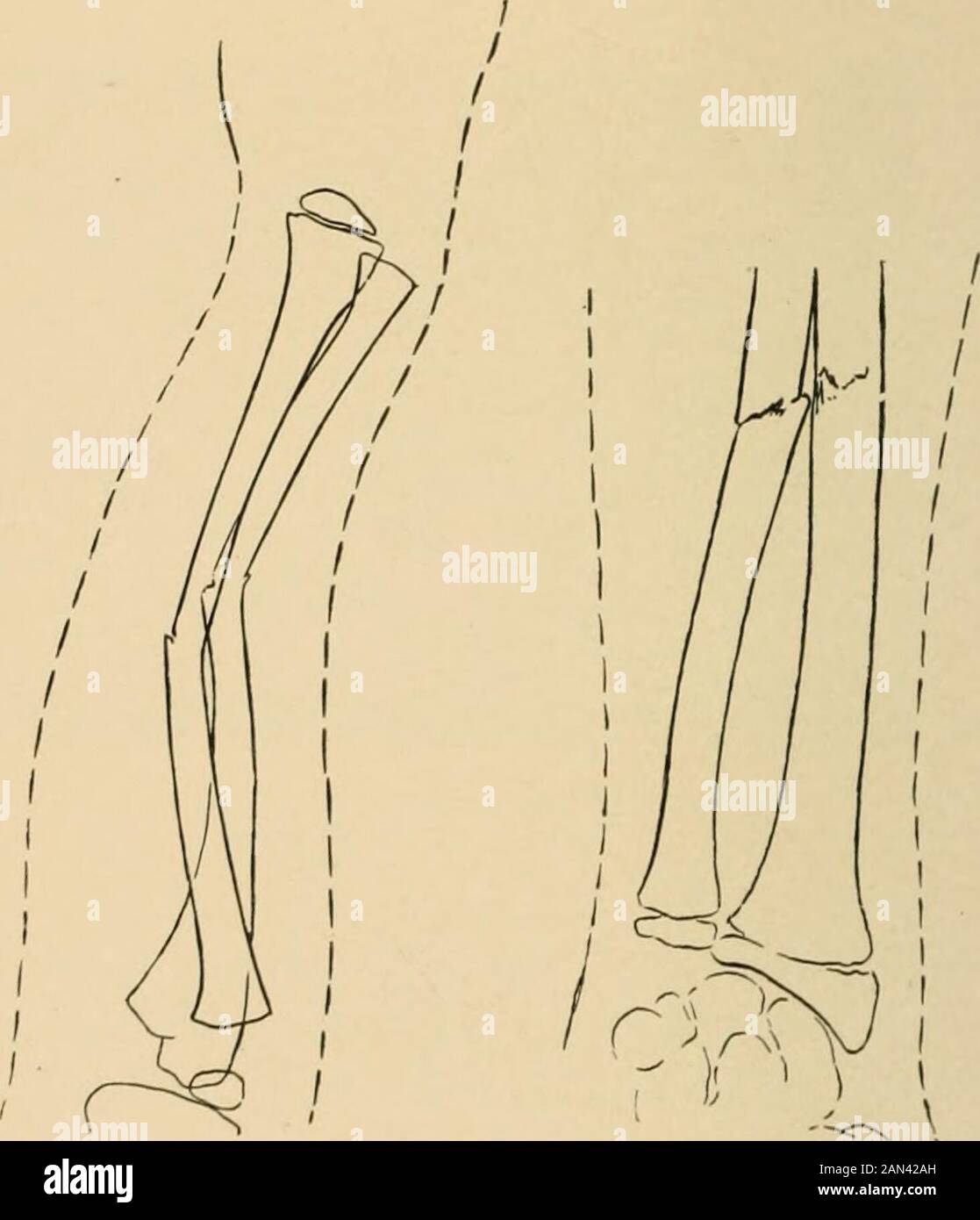 Pronation-supination movement angle.