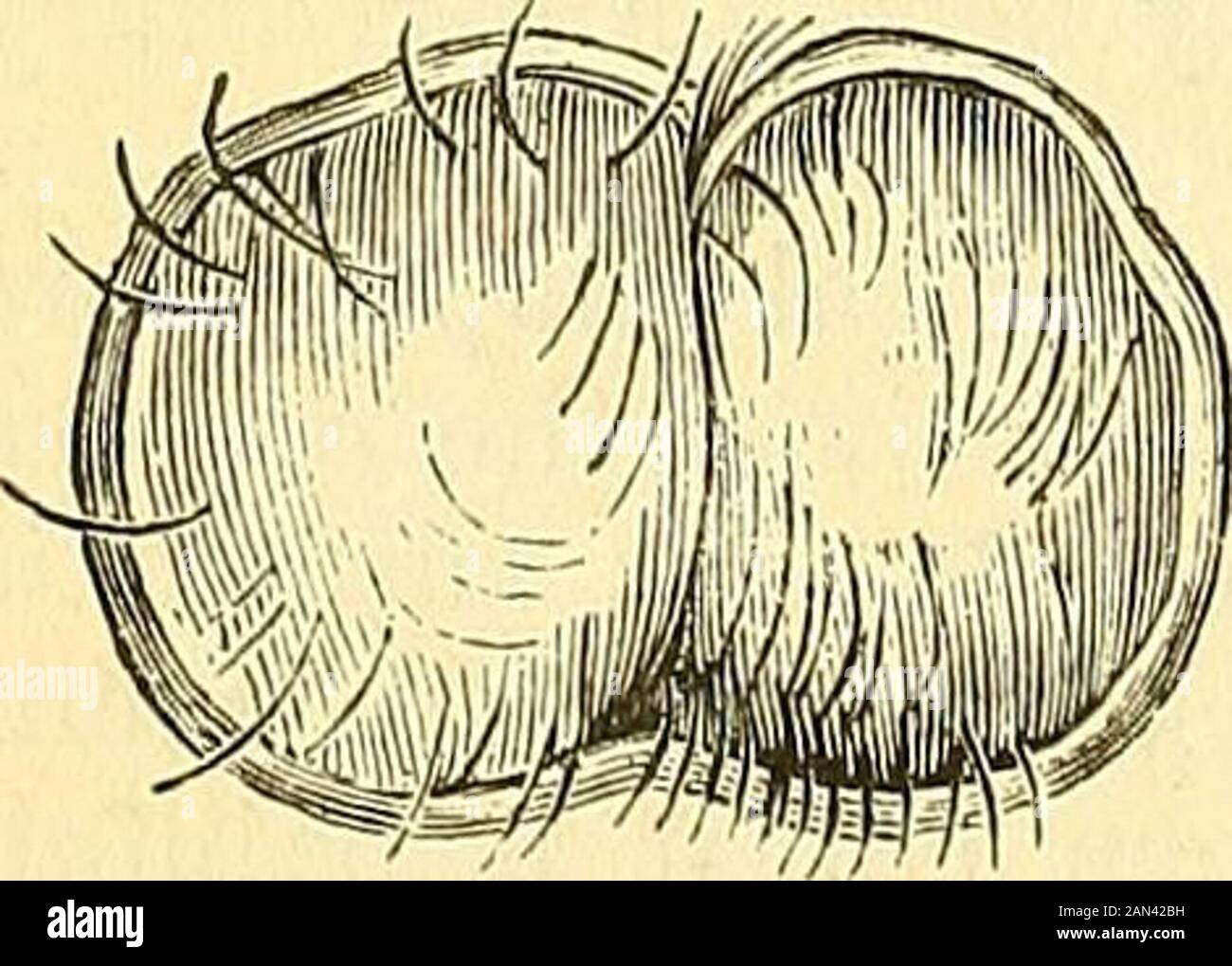 A system of surgery : pathological, diagnostic, therapeutic, and operative  . ty, or athick mixture of flour and water. Some-times the contents of a  tumor of this kind are thin, almost watery,