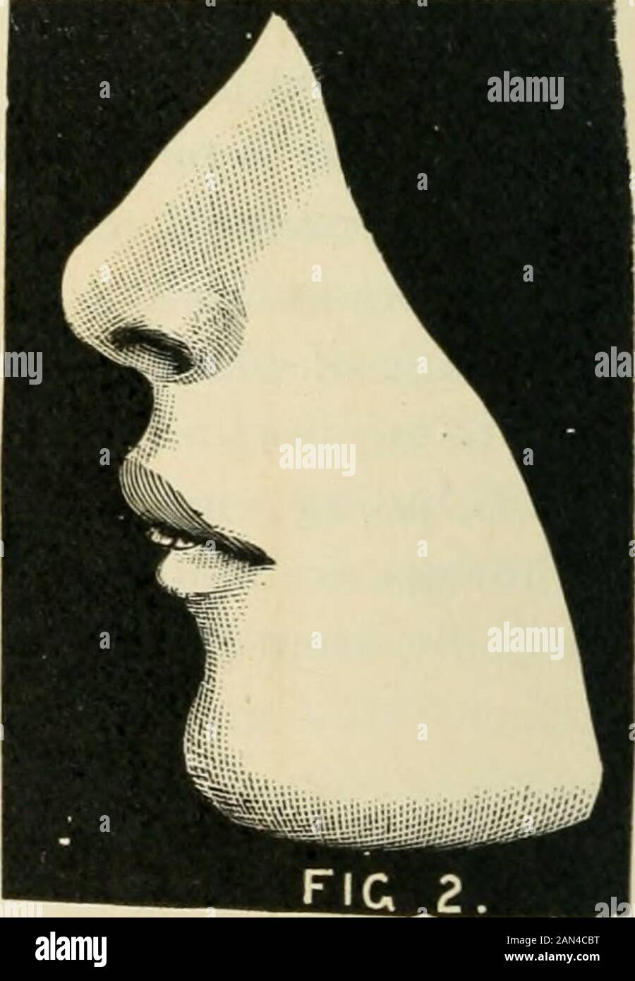Transactions of the Illinois State Dental Society, 1892 . and jaw, with ...