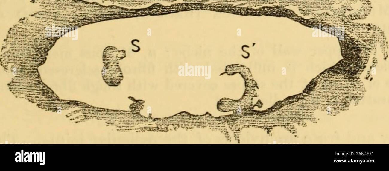 A text-book of the diseases of the ear and adjacent organs . Fig. 122.—Niche of the Fenestra Ovalis, with the Crur.e of the Stapes inthe Normal Ear of an Adult. Network of Bands extending from the Neckof the Stapes to the Walls of the Niche. c, Head of the stapes ; ss, Cruree of the stapes. numerous membranous striae and bands, which often cross each other, andby which the membrana tympani, the ossicula, and the tensor tendon, areabnormally connected with each other and with the walls of the tympanum,producing abnormally increased tension of the sound-conducting apparatus. Fig. 123.—Cross Sect Stock Photo