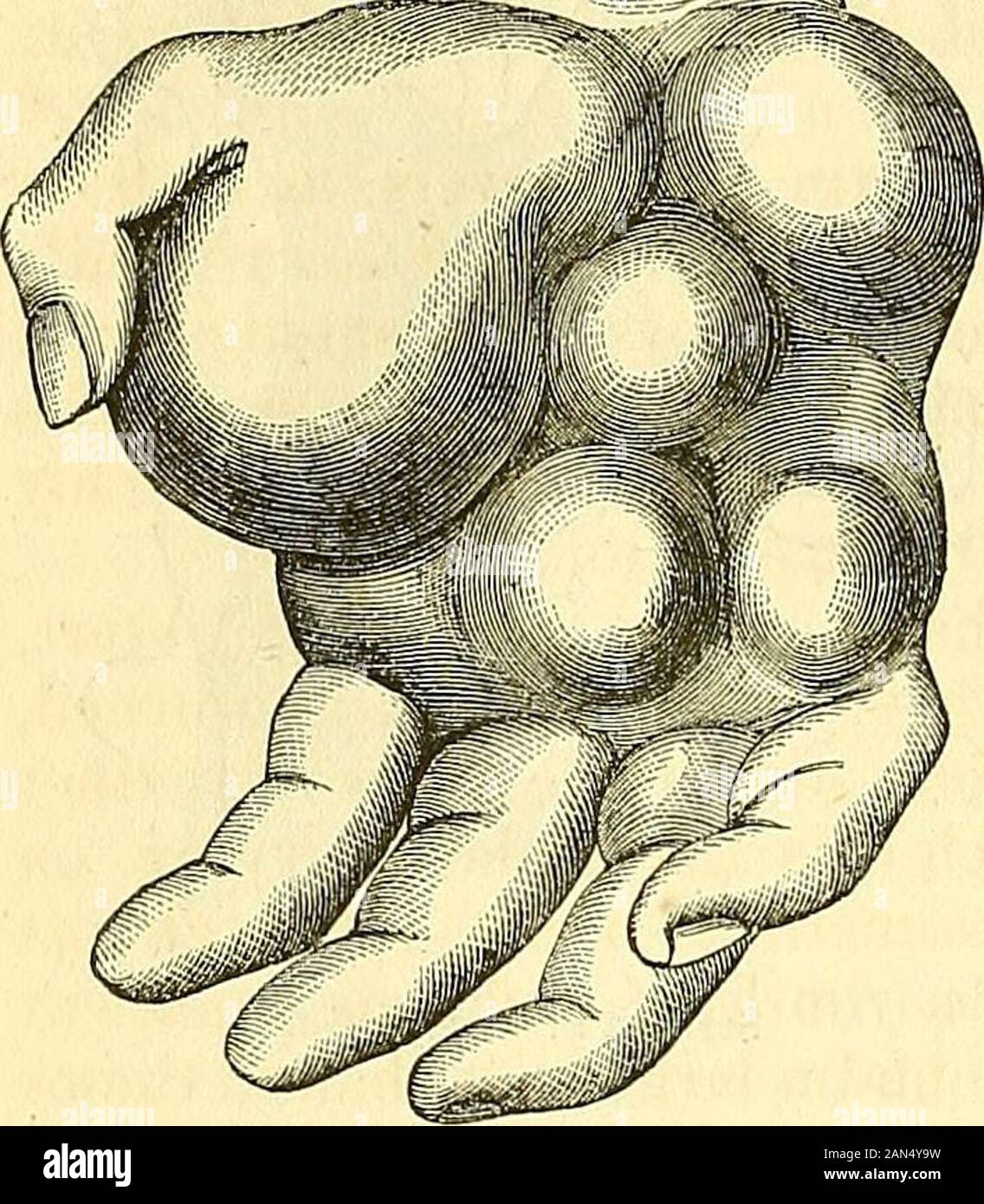 Tuberoid hires stock photography and images Alamy