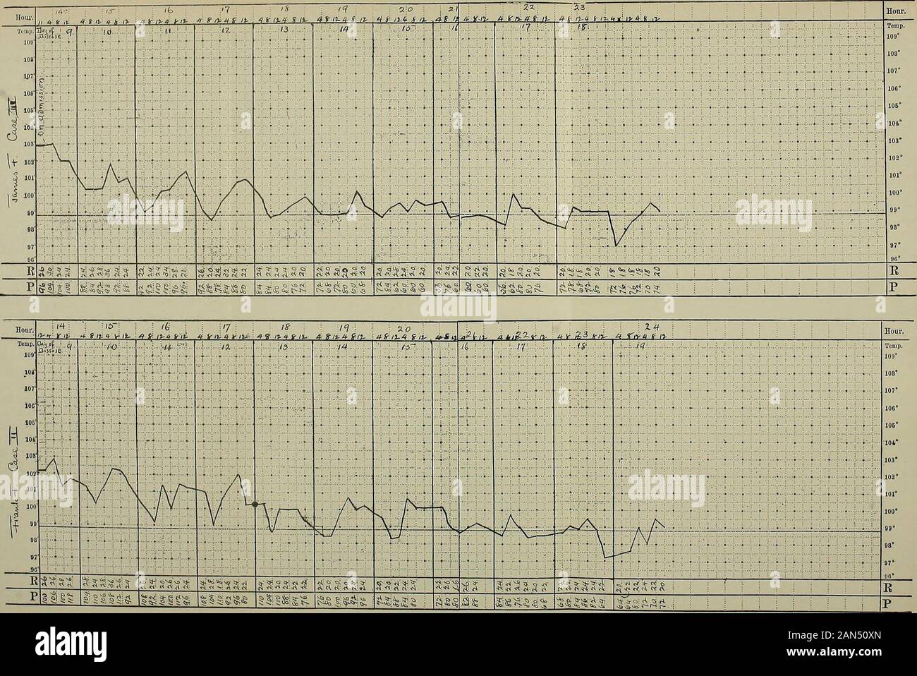Medical and surgical report of the Presbyterian Hospital in the City of New York . admission, the temperature was 102.2° F.; pulse, 100; respira-tion, 26. He was a poorly nourished boy; very much prostrated andintensely apathetic. Respiration was a little rapid but not labored.There was moderate pectus carinatum. The tongue was dry, brown,cracked, and heavily coated. The teeth were covered with sordes;the lips dry, cracked, bleeding; the gums soft, red, with several aphthouspatches. The pharynx and tonsils were dry and red. All of the superficiallymph-nodes were palpable. The heart was normal Stock Photo