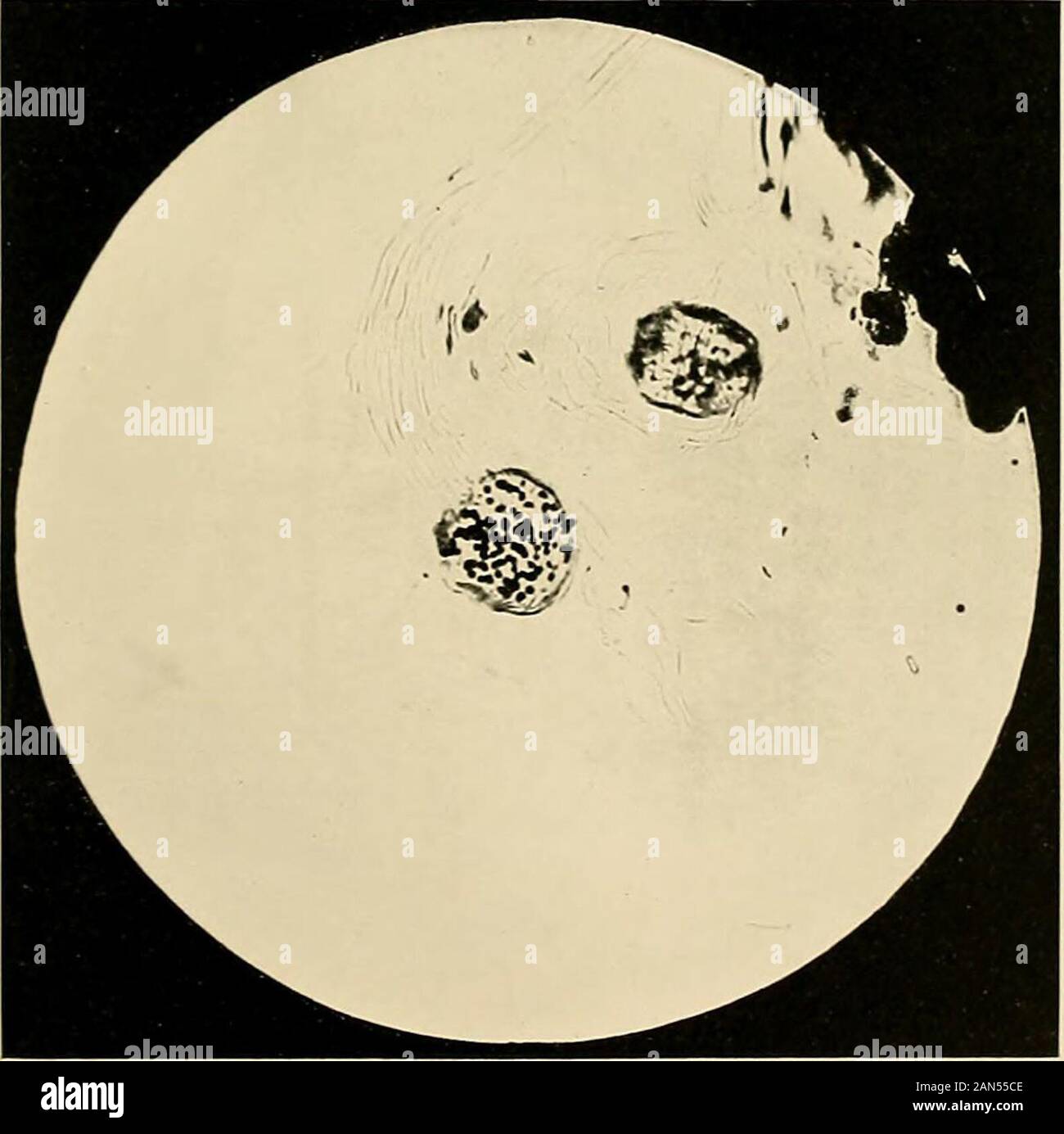 Ringworm in the light of recent research pathology, treatment