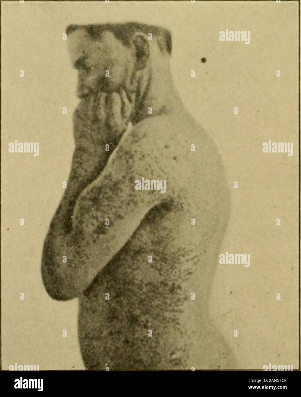 Warm water skin medical hires stock photography and images Alamy