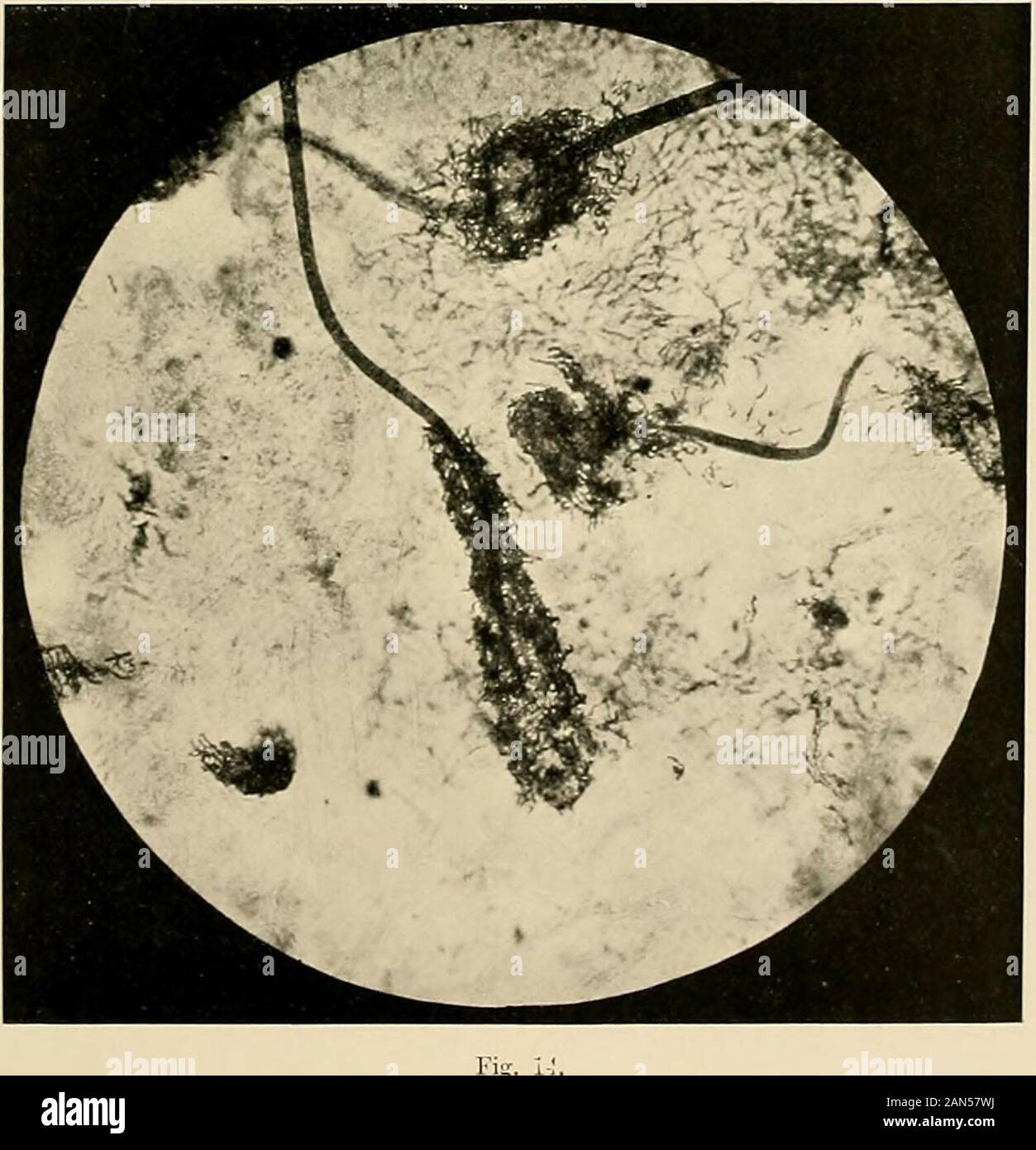 Tinea imbricata hires stock photography and images Alamy
