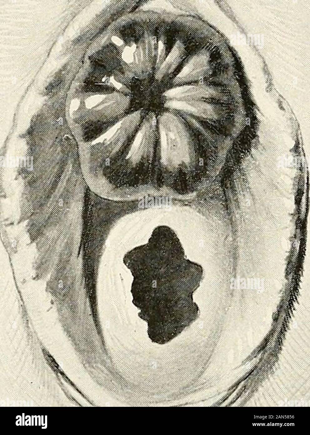 Urethral meatus hires stock photography and images Alamy