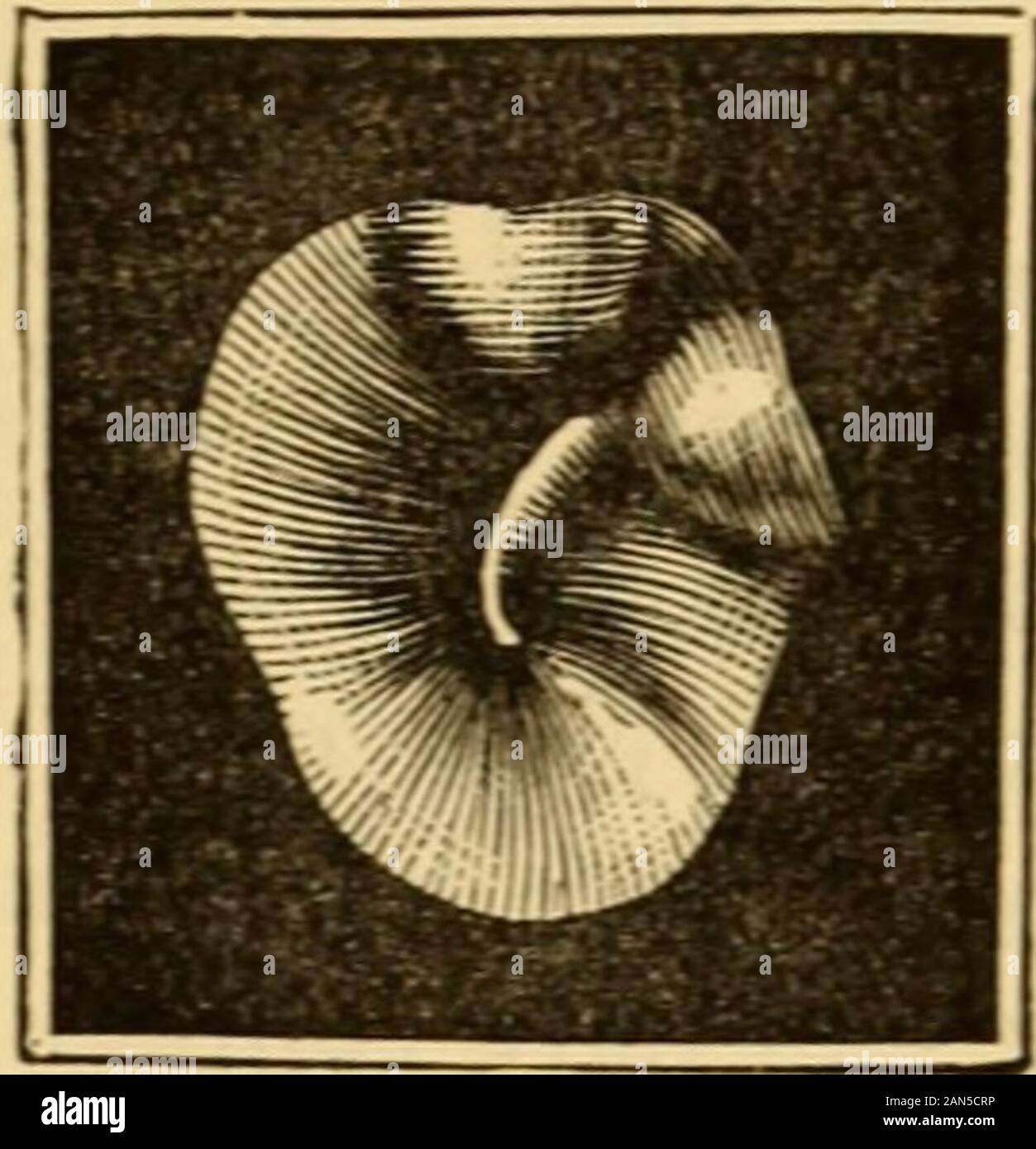 A text-book of the diseases of the ear and adjacent organs . Fig. SS. CONTRACTIONS OF THE EXTERNAL AUDITORY MEATUS. 211 passages, and agreeing on the two sides in regard to form. Theirsite is the middle and inner sections of the osseous meatus. Theyare sessile or pedunculate, but never reach such a size as to com-pletely fill the meatus. 2. Circumscribed, chronic periosteal inflam-mation in the osseous meatus. To these belong the round exostoses(Osteophytes) which, according to Wagenhauser, occur from trau-matic fractures of the anterior wall of the meatus. 3. Diffuse inflam-mations of the ext Stock Photo