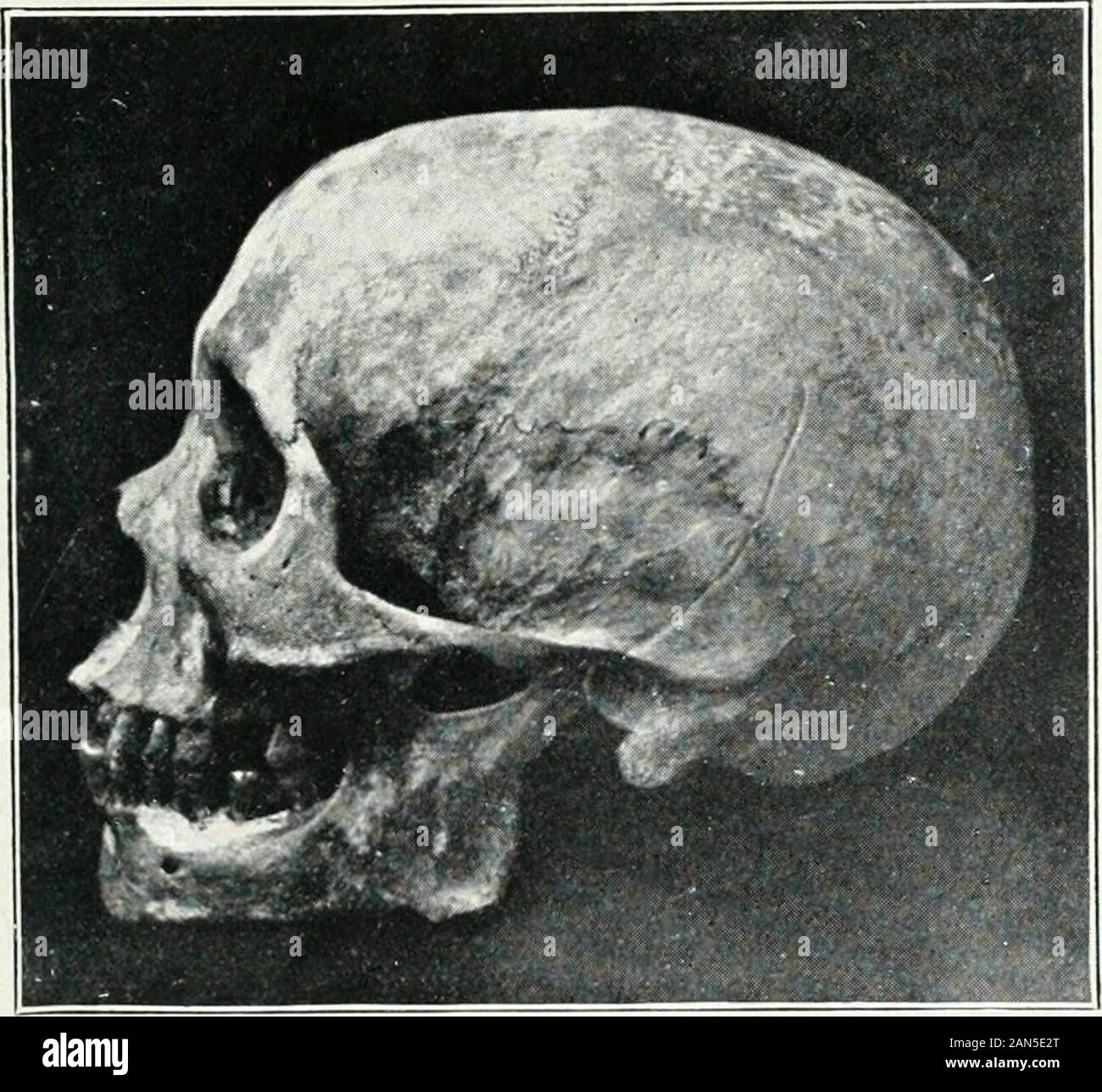 Pagan Races Of The Malay Peninsula Skcat Collection Slvull Ok Semang Skeleton As Viewed From Above Procured At Ulii Siontr Kedah Skcat Collection Skull Of Semang Skeleton Side View Belonging To Skeleton Procured At