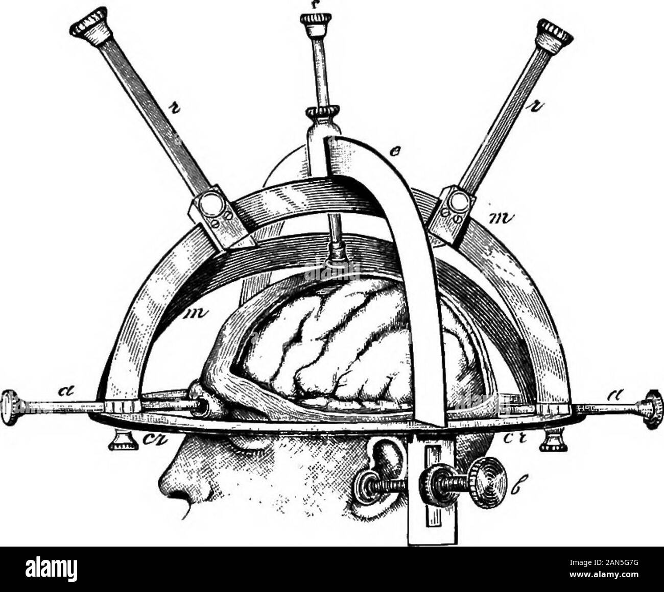 An illustrated encyclopædic medical dictionaryBeing a dictionary of the  technical terms used by writers on medicine and the collateral sciences, in  the Latin, English, French and German languages . ary car-cinoma.  ENCEPHAtOMAlACIA (