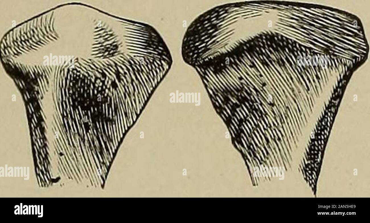 Journal of the Academy of Natural Sciences of Philadelphia . Fi ;. 21.—Eight condy-loid process of lowerjaw, showing largetubercle. Fig. 22.—Condyloid processes of lowerjaw of an Oneida Indian. 1.Right side inclined outward withboth degrees of angulation ob-scure. 2. Left side, nearlv level. as present in the 430 CRANIA FROM THE MOUNDS OF FLORIDA.. Stock Photo
