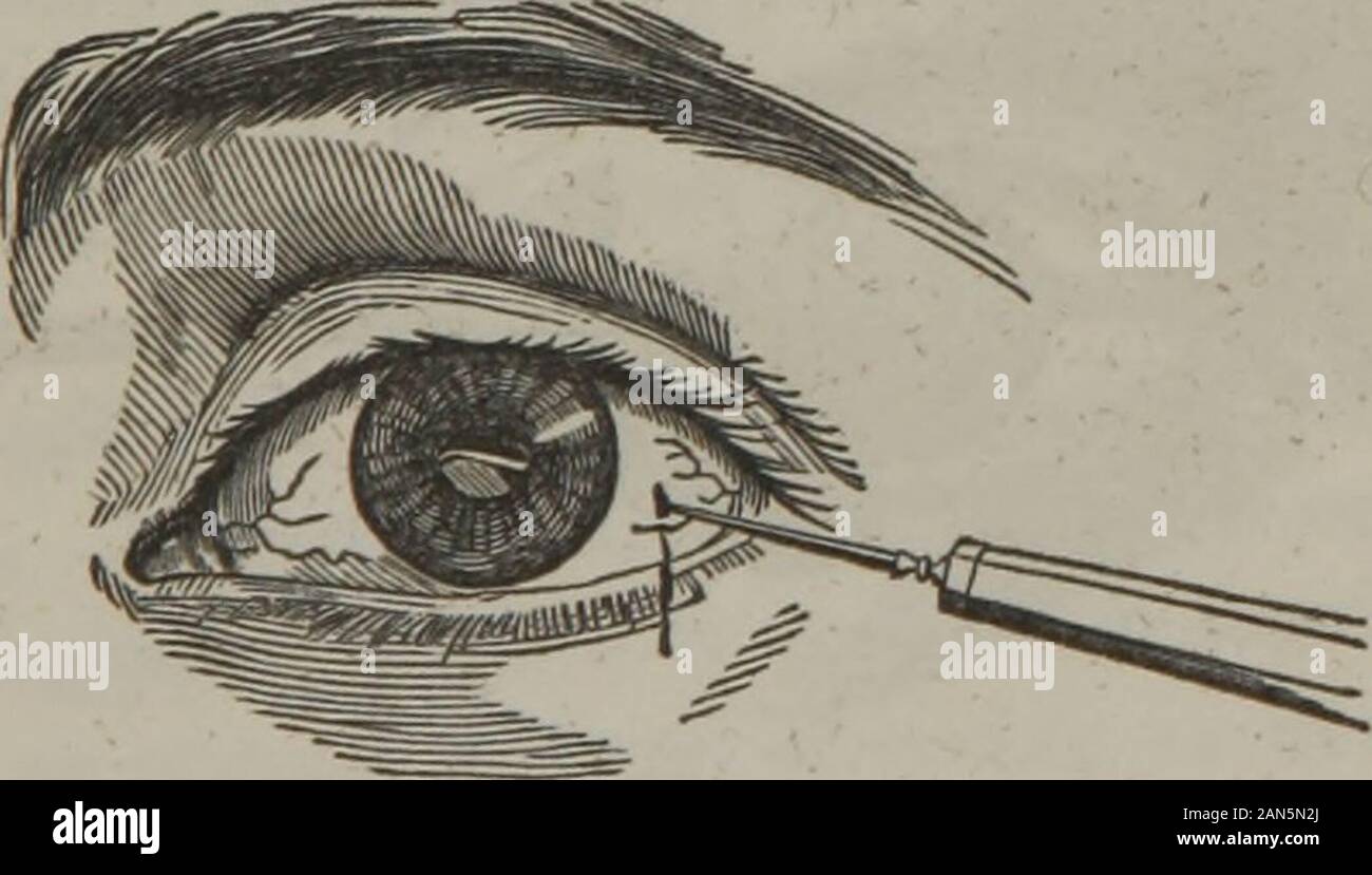 The Practice Of Surgery Embracing Minor Surgery And The Application Of Dressings Etc Etc Etc Peration Free Depletion Is Occasionallynecessary Even In Old Persons There Are Several Operations Performed