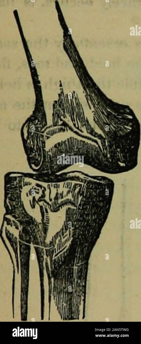 Condyles of femur hi-res stock photography and images - Alamy