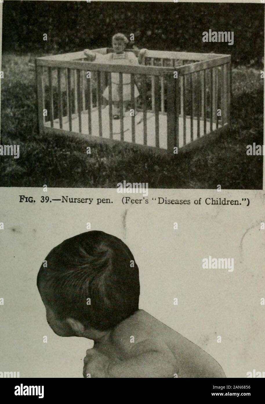 Care and feeding of infants and children; a text-book for trained nurses . Fig. 38.— At six months the baby not only lifts its head but begins raising its bodyon its arms. to make as free movements as possible. At about three or fourmonths, if a baby is placed on the stomach, it will begin holdingup its head, thus bringing into use the muscles in the neck andback (Fig. 38). At five or six months, the baby not only liftsits head but begins raising its body on its anus and also makingattempts to bring into use the muscles of the thighs, so that bythe eighth or ninth month it begins to raise itse Stock Photo
