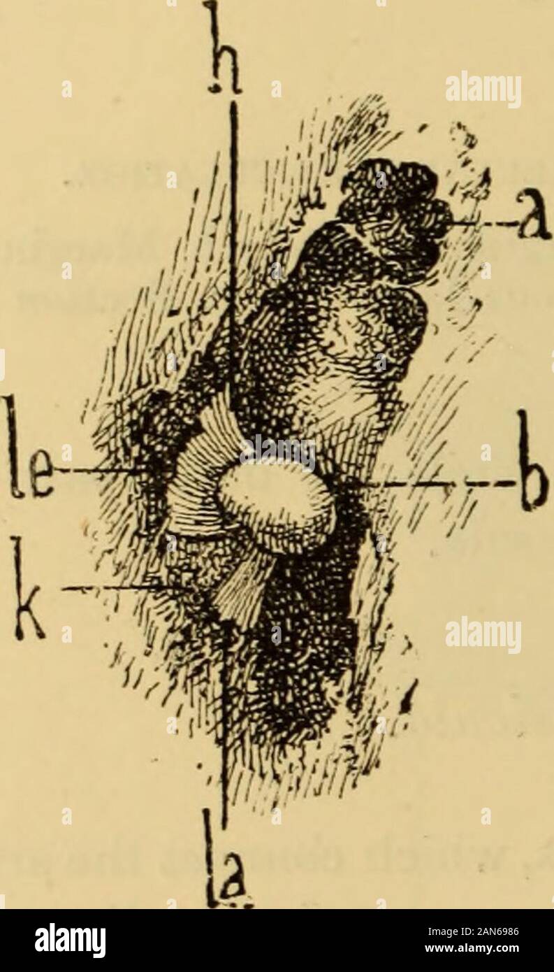 A text-book of the diseases of the ear and adjacent organs . ersect themiddle fibrous prolongations of the anterior ligament, and as the axis on 32 LIGAMENTS OF THE OSSICULA. which the malleus turns passes through these two fibrous prolongations,Helmholtz calls them the ligaments of the axis of the malleus. 4. Posteriorligament of the incus (Fig. 35, b, b). The short process of the incus, coveredwith a thin layer of fibrous cartilage, leans on the saddle-shaped depressionof the posterior wall of the tympanic cavity, at the entrance to the mastoidprocess. Of the fibrous prolongations, which con Stock Photo