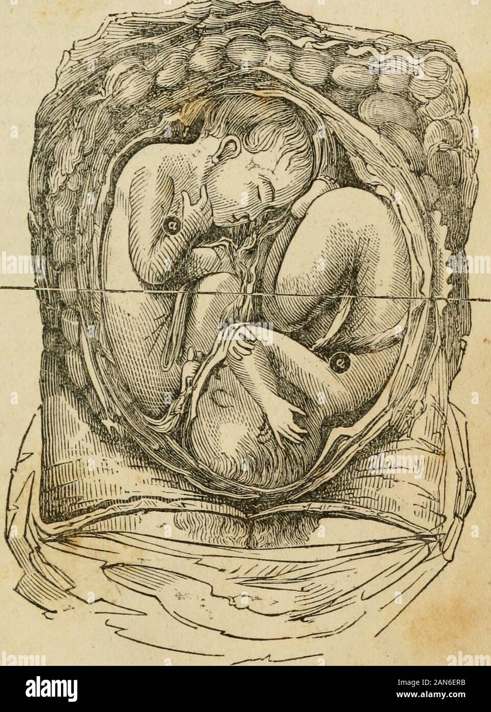 Breech Position Hi Res Stock Photography And Images Page 2 Alamy
