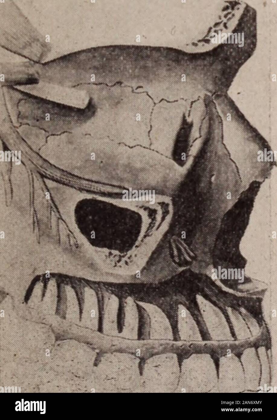 Dental review; devoted to the advancement of dentistry. . canals -  ChS^;ScAL. .. Rosin qr.xTT . .. canals)^ 17 Vital Pulps Fig. 18. Fig. 19.  ORIGINAL COMMUNICATIONS. 791Figure No. 9 shows the