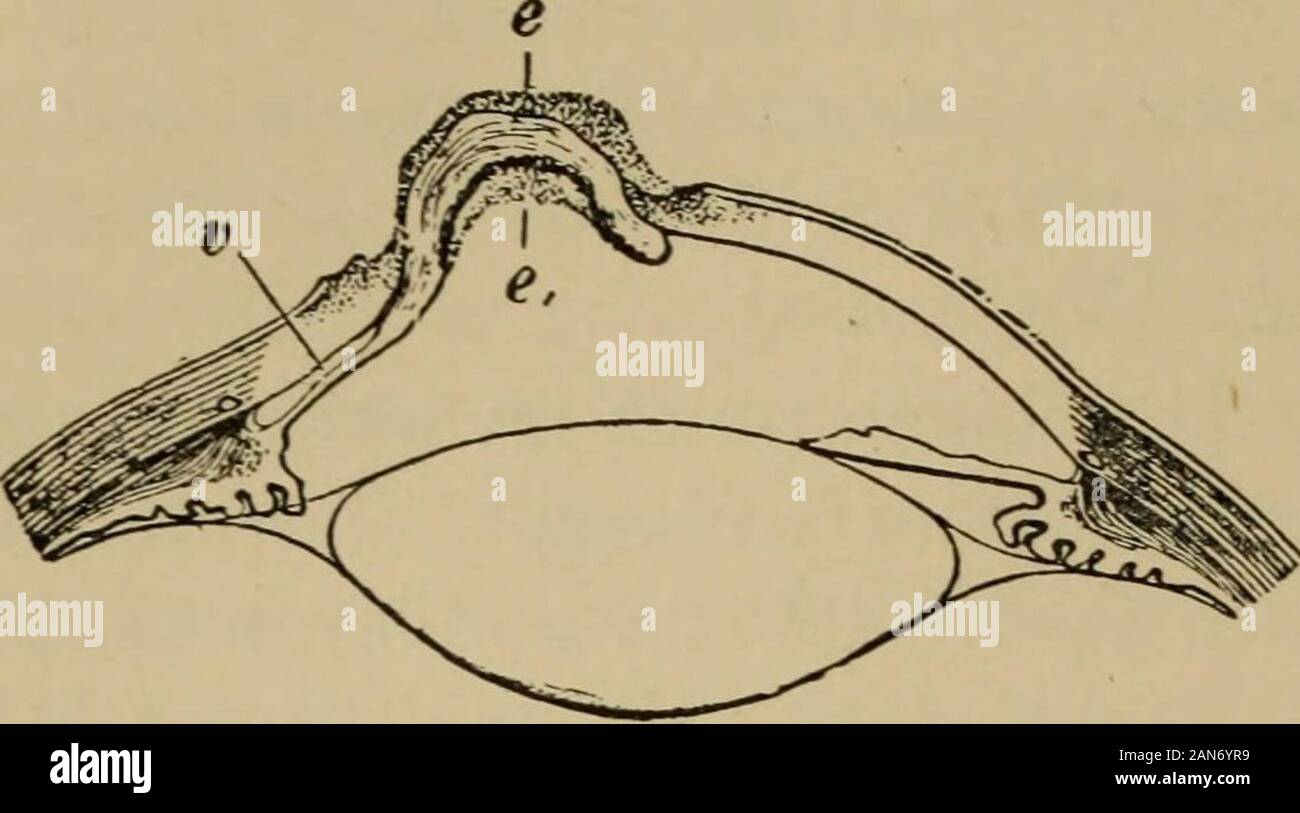 Text-book of ophthalmology . we see lying in it the iris which has been swept into the wound by thejet of escaping aqueous. The eye feels quite soft. Perforation is sometimes preceded by a keratocele.7 For, Descemetsmembrane being distinguished by the great resistance which, in comparisonwith the corneal lamellae, it offers to the inflammatory process, it often hap-pens that the stroma of the cornea is destroyed throughout its entire thick-ness by suppuration, while Descemets membrane still remains resistant.In that case it is protruded by the intra-ocular pressure under the form ofa transpare Stock Photo
