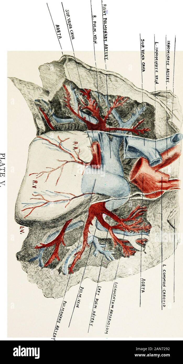 The signs of internal disease, with a brief consideration of the principal symptoms thereof . les as eleven ounces (310 grams), in females nineounces (250 grams). The Valves of the Heart. Each side of the heart is equipped withtwo valves. One guards the opening between the two chambers, theauricle and its corresponding ventricle, the other, placed within theventricle, closes the aperture of the great vessel which springs there-from, viz:—the aorta on the left and the pulmonary artery on the rightside. Three of these valves are made up of three cusps, or leaflets,each, while the remaining one c Stock Photo