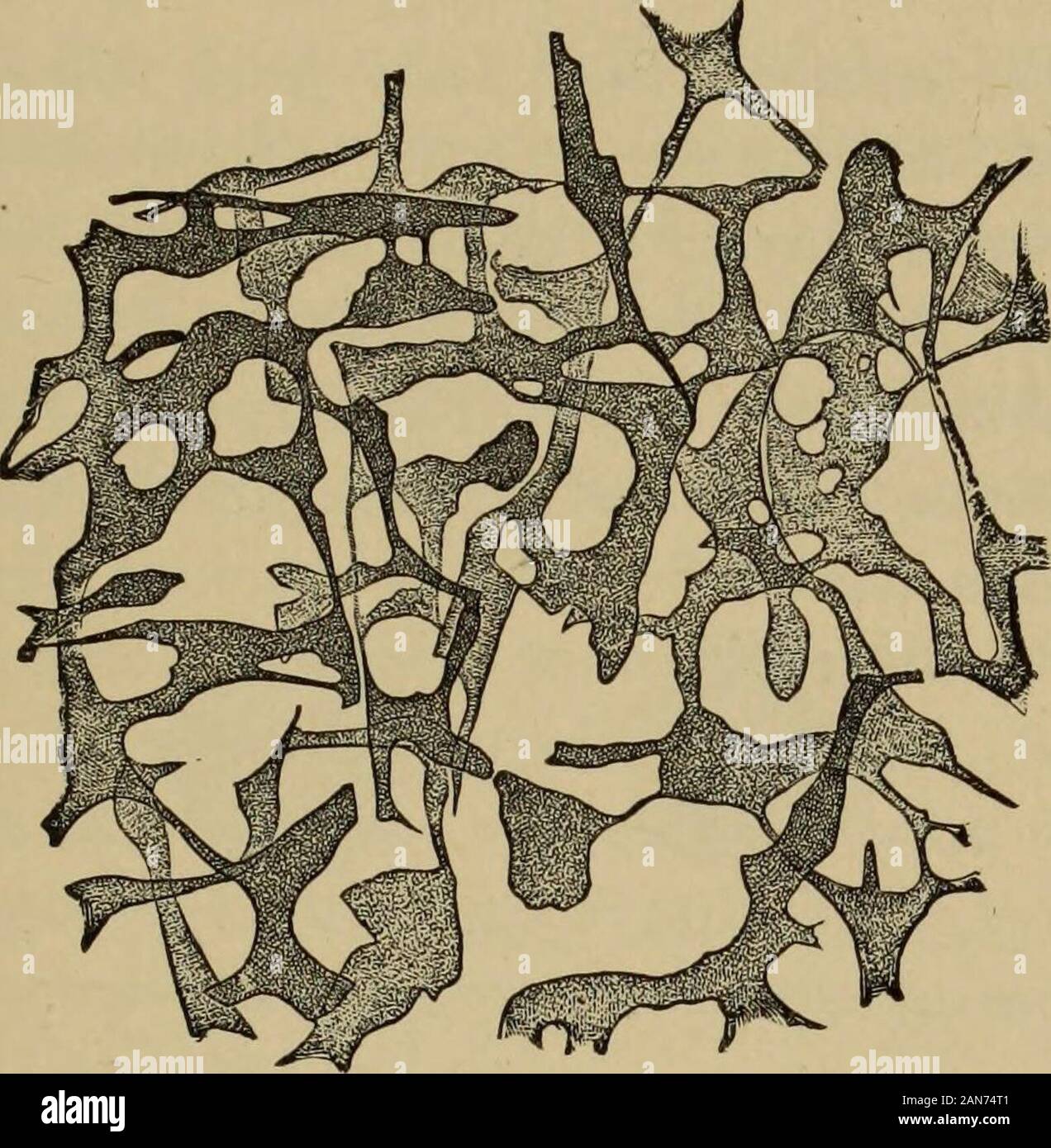 Textbook of ophthalmology . a of the cornea has broken down into pus, we oftensee the thin