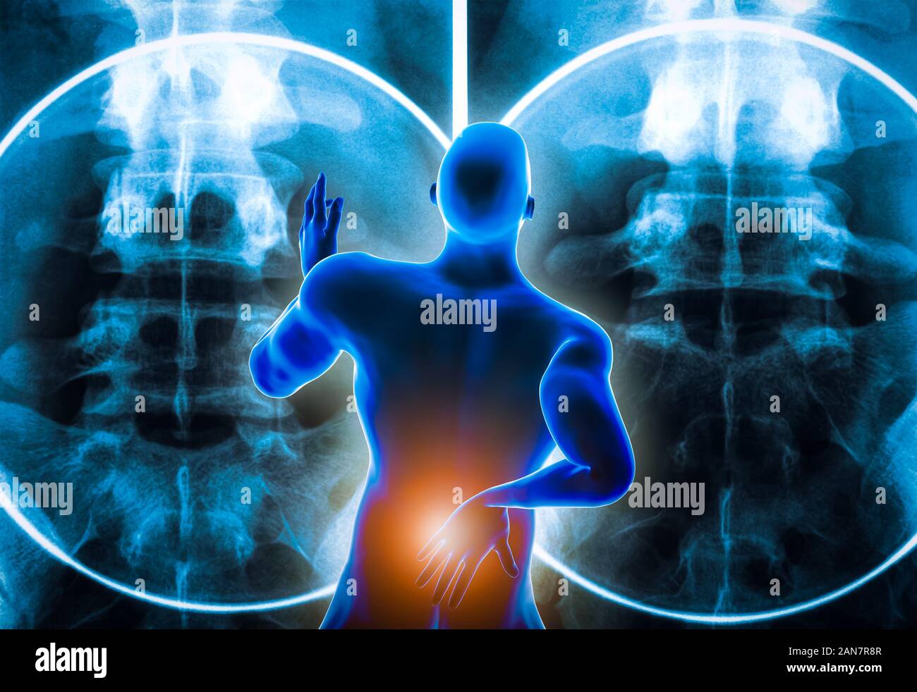 Back view of a man suffering from an acute lumbar back pain or discal hernia or lumbago with backbone x-ray imagery in the background. 3D rendering il Stock Photo