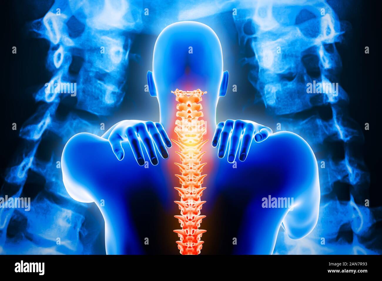 Man back body with spine and xray vertebrae imagery in the background