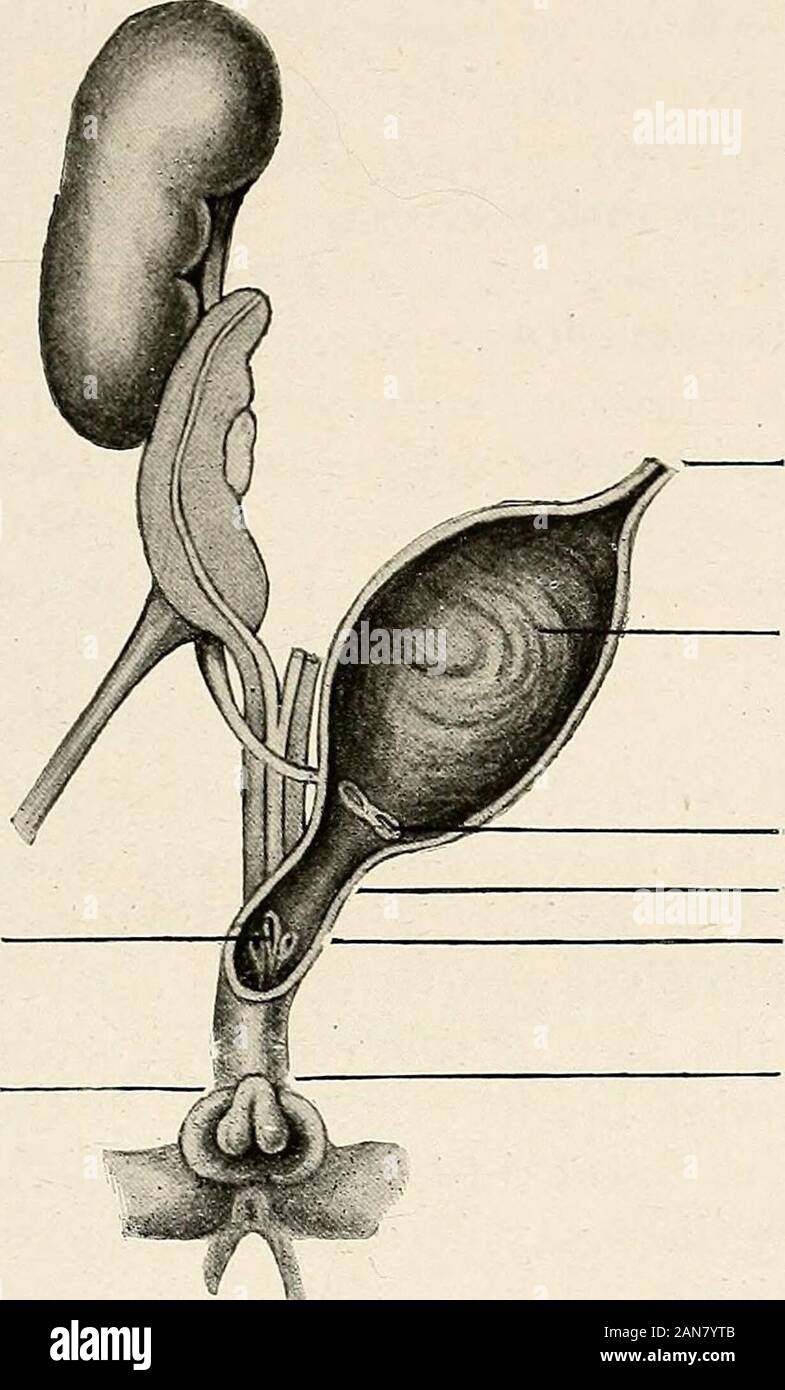 Gynaecology For Students And Practitioners Whilst The Short Pouch Below Which Is Nov The Sole Remaining Part Of The Original Sinus Urogenitalis Becomes The Vestibide And Fossa Navicularis The Former Is Muchdeeper Gynaecology For Students And Practitioners Whilst The Short Pouch Below Which Is Nov The Sole Remaining Part Of The Original Sinus Urogenitalis Becomes The Vestibide And Fossa Navicularis The Former Is Muchdeeper
