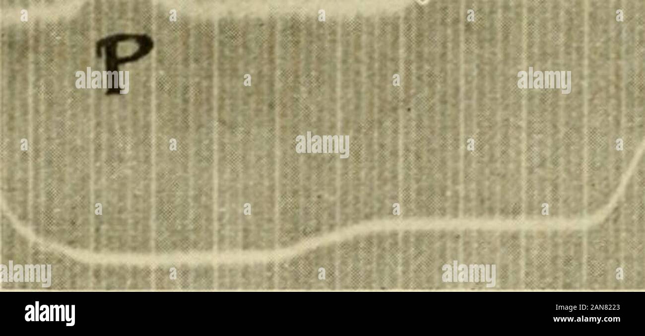 Physiology and biochemistry in modern medicine . This can be done by local warming of the apex, or by applyingthe ventricular electrode at varying parts of the ventricle in an excisedheart beating in Ringers solution of relatively high H-ion concentra-tion. Mines showed that under these conditions a typical T-wave ap-pears in the electrocardiogram, as shoAvn in Fig. 84.* The existence of the small Q-wave, indicating that the contractiondoes not really start from the base, conforms with the observation thatthe Purkinje system of fibers ends about the papillary muscles, whichtherefore would be t Stock Photo