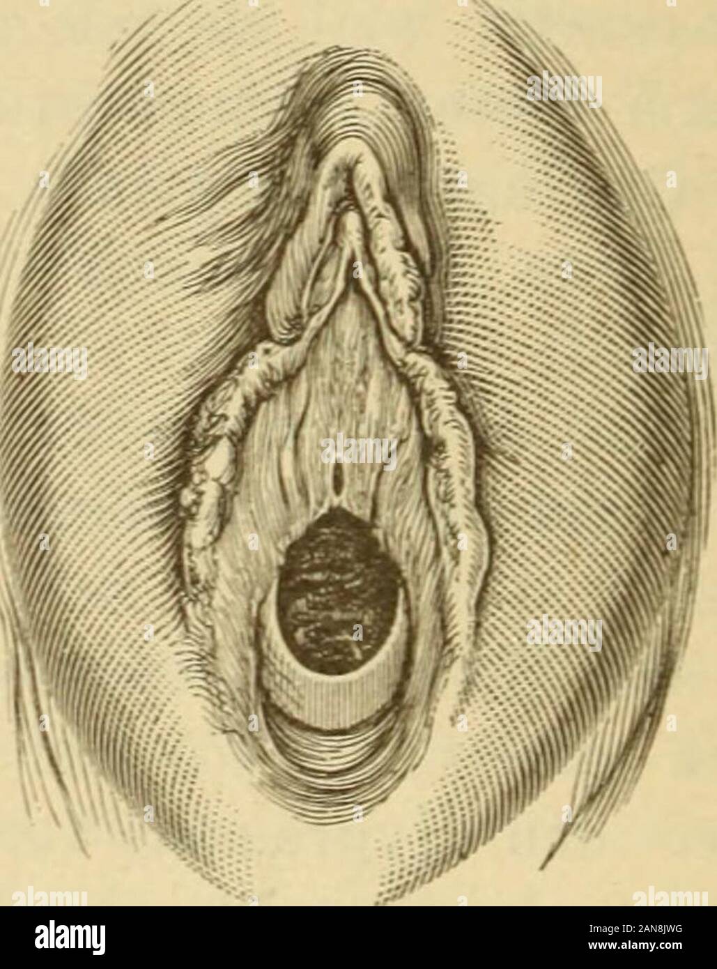 Das wie jungfernhäutchen liegt tief