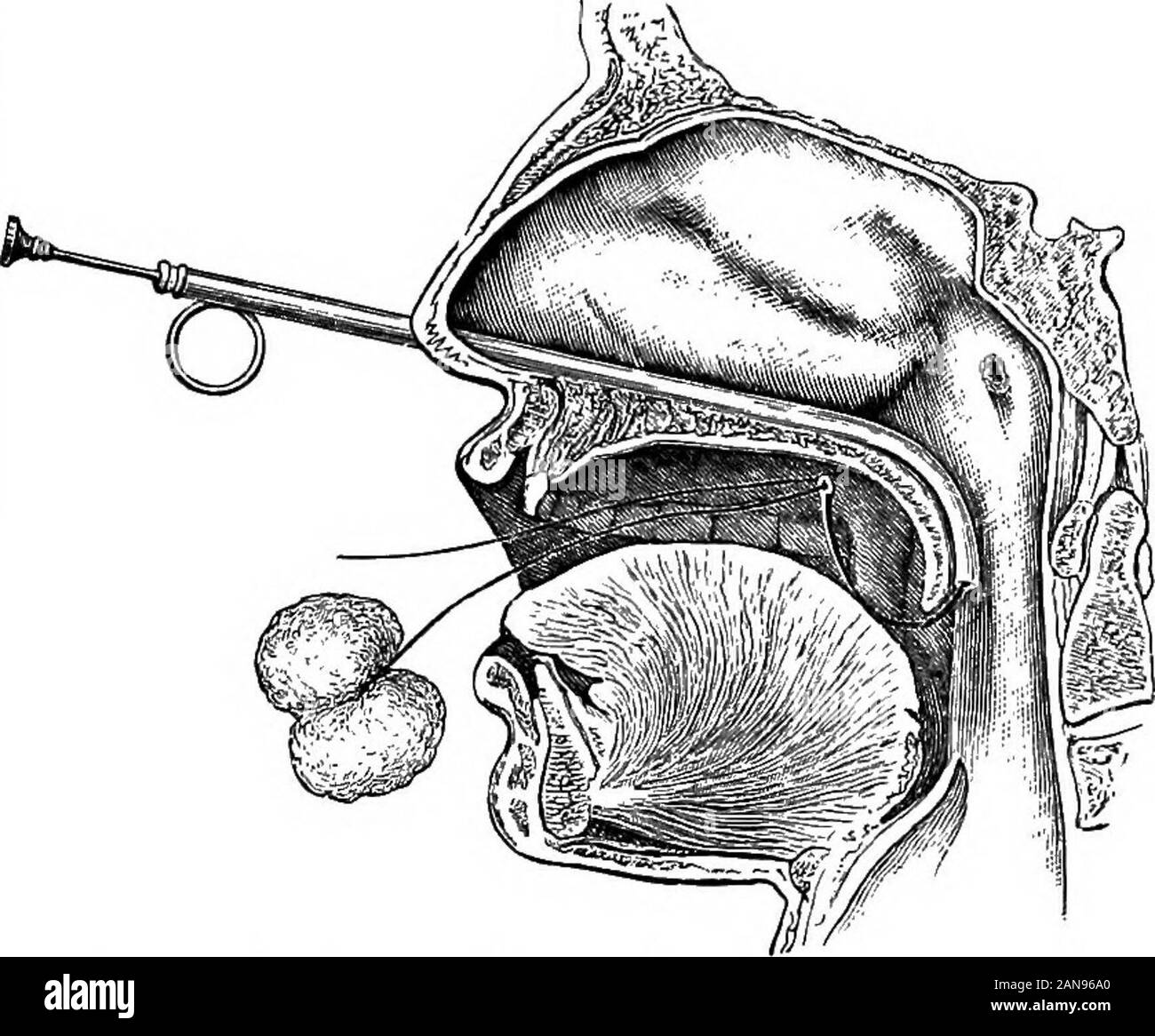 An illustrated encyclopædic medical dictionaryBeing a dictionary 