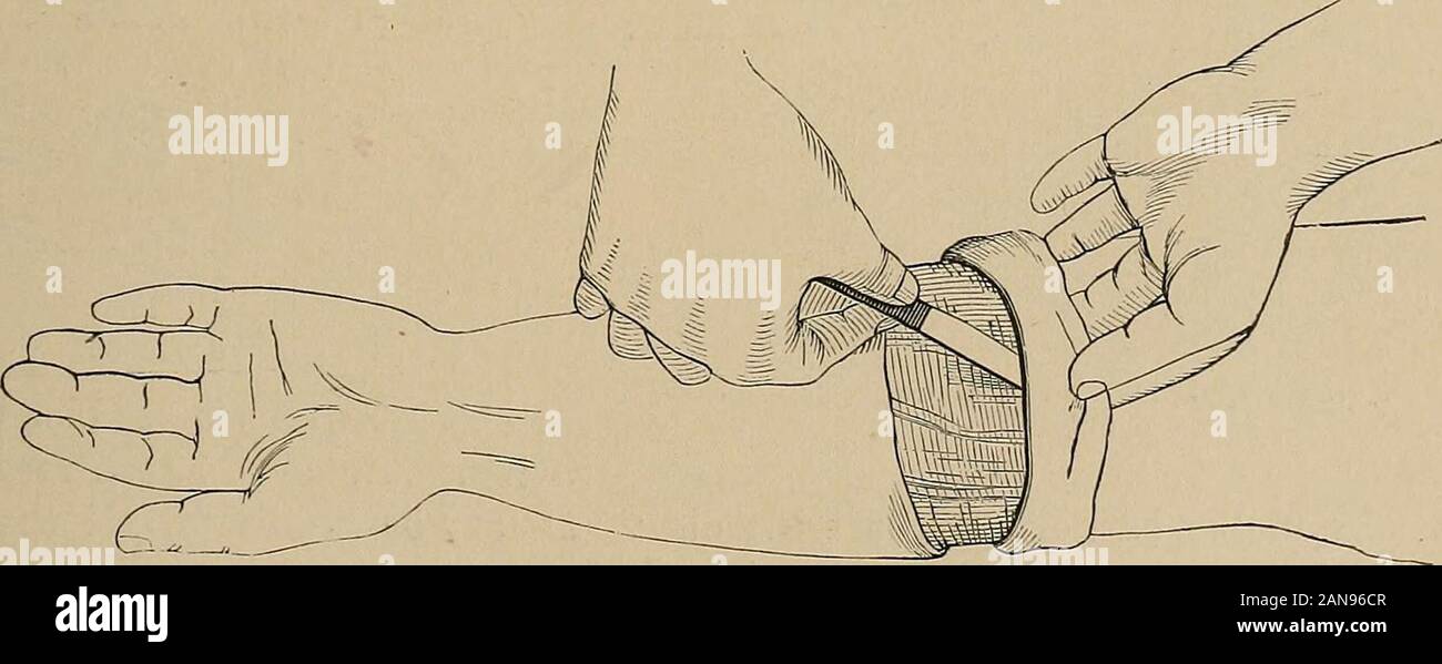 Esmarch bandage hires stock photography and images Alamy