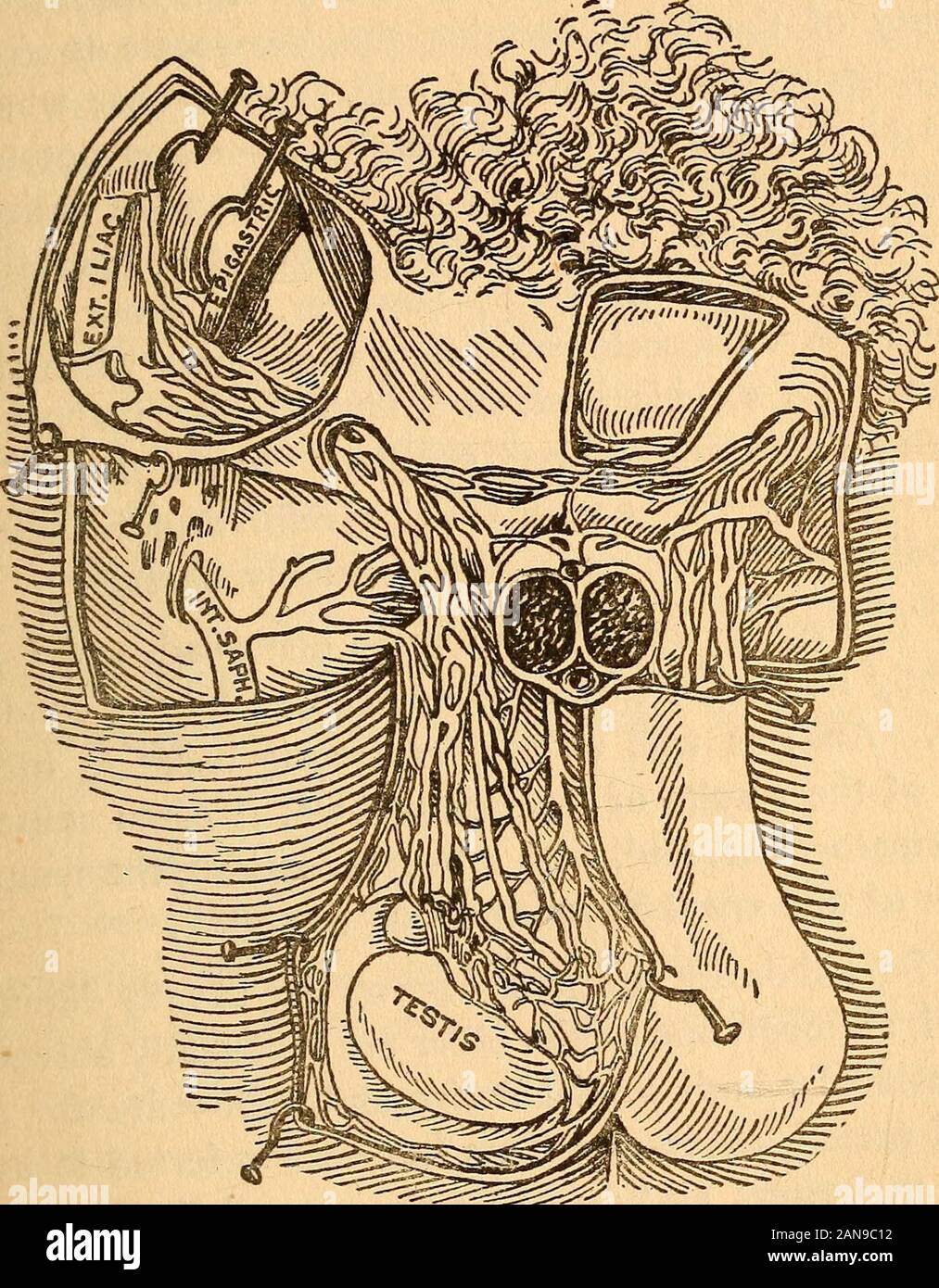 Man's mission on earth : a contribution to the science of eugenics : a short treatise on the genito-urinary organs of the male in health and disease, with a chapter on syphilis . hyexists, and in all cases nervous derangement occurs,extending to the other organs and affecting themental powers of the sufferer. Varicocele is in-variably a serious drag on the general health; it causesdyspepsia from constant nervous irritation, and gen-erally unfits the patient for mental or physical labor. The sufferer no longer pursues his daily voca-tion with pleasure or profit. The responsibilities ofsturdy ma Stock Photo