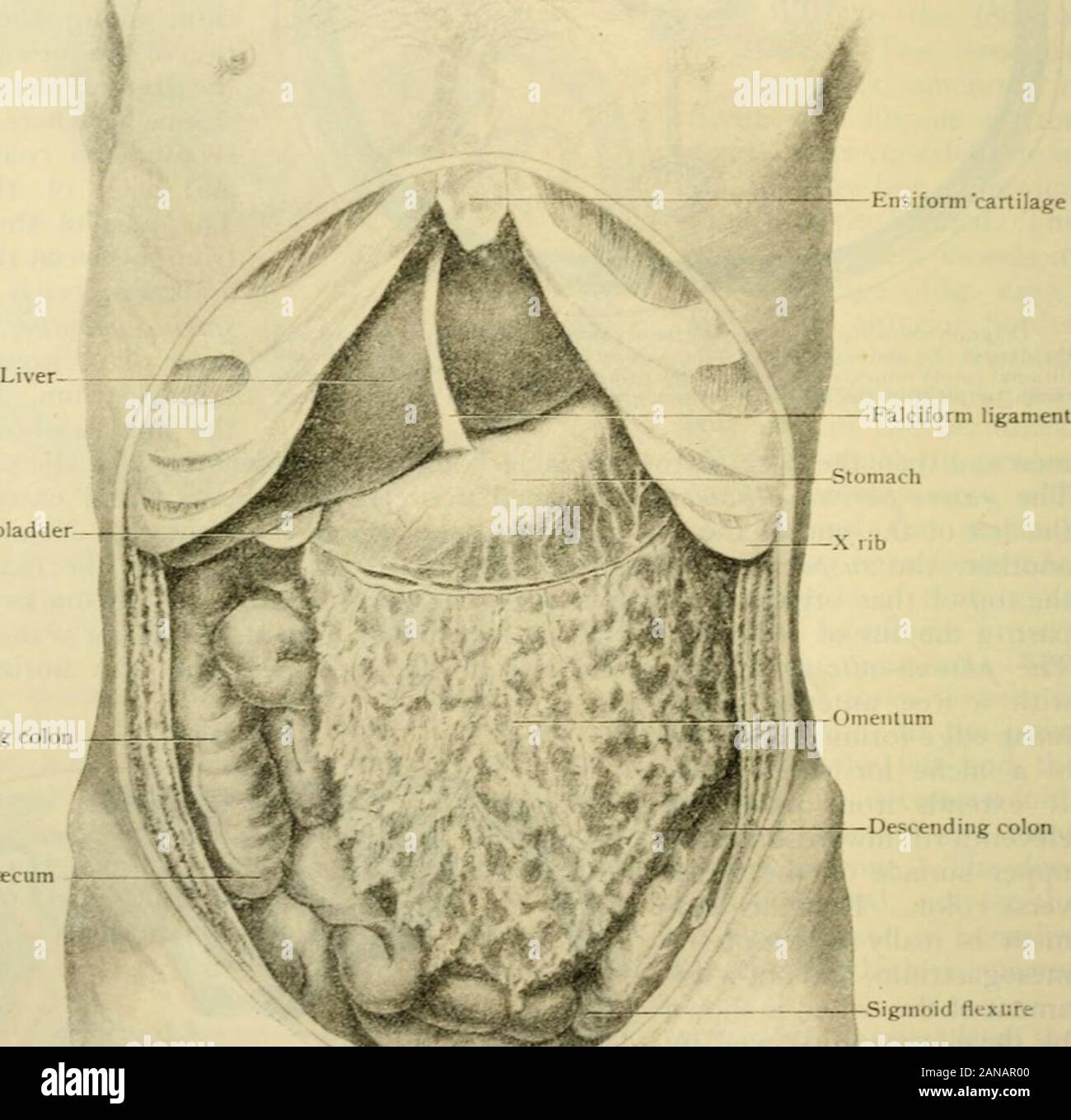 Human anatomy, including structure and development and practical considerations . Diagrammatic section passing through level of foramen of VVinslow,showing relations of parietal and visceral peritoneum within lesser sac(I.S) GH, cut gastro-hepatic omentum, containing portal vein (P), he-patic arten,- (iy),and bile-duct {B) St. stomach ; 6.S, gastro-splenic omen-tum ; LR, lieno-renal omentum ; VC, A, vena cava and aorta. 1748 HUMAN ANATOMY cur-ature of the stomach, where it is continuous on the left with the double layercoming from the spleen and on the right with that coming from the inferi Stock Photo