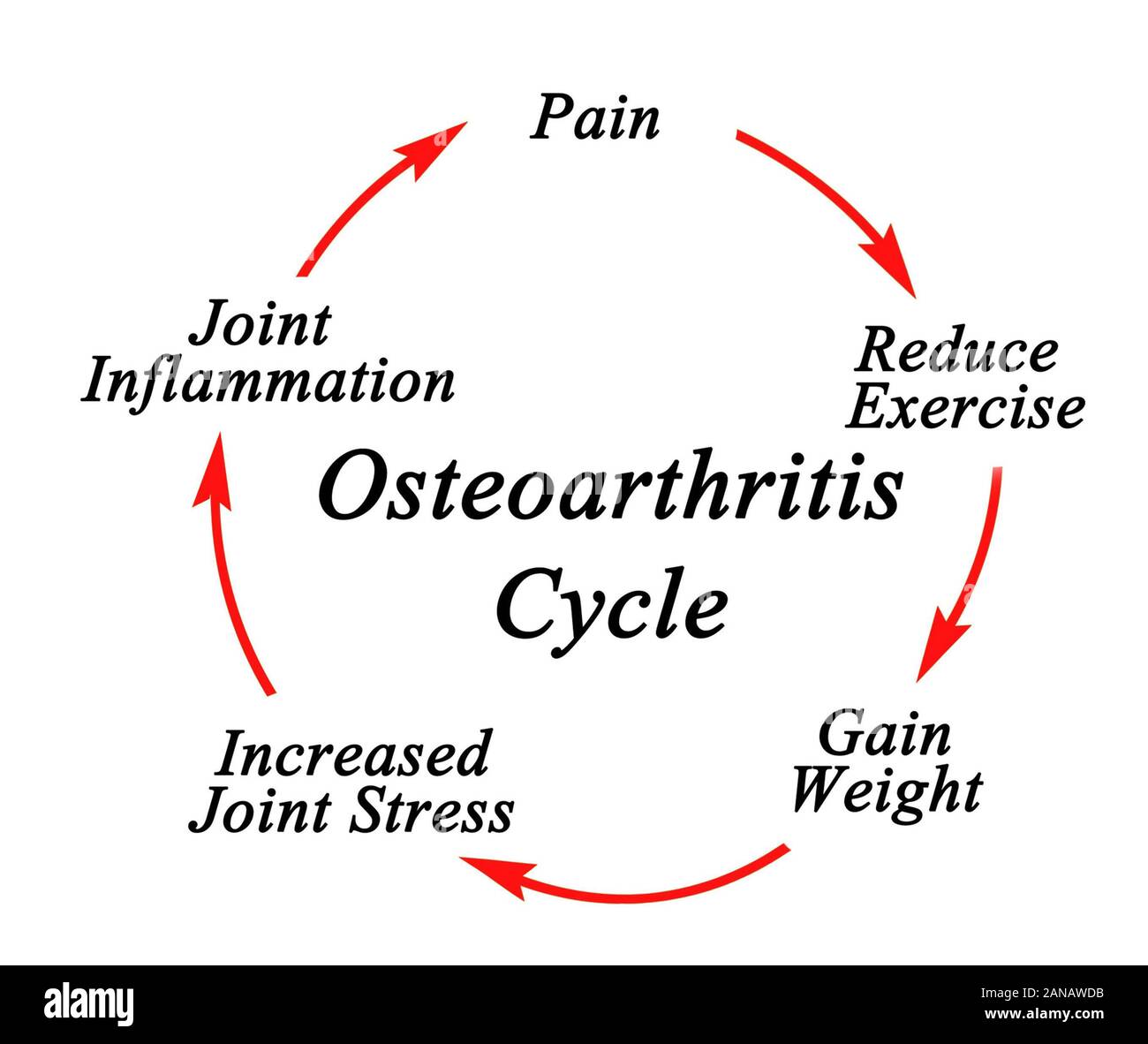 Five components of Osteoarthritis Cycle Stock Photo Alamy