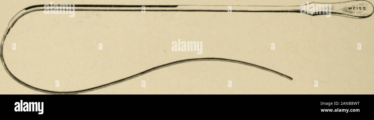 Filiform Instrument Clinical lectures on the surgical diseases of the urinary organs . Fig ...