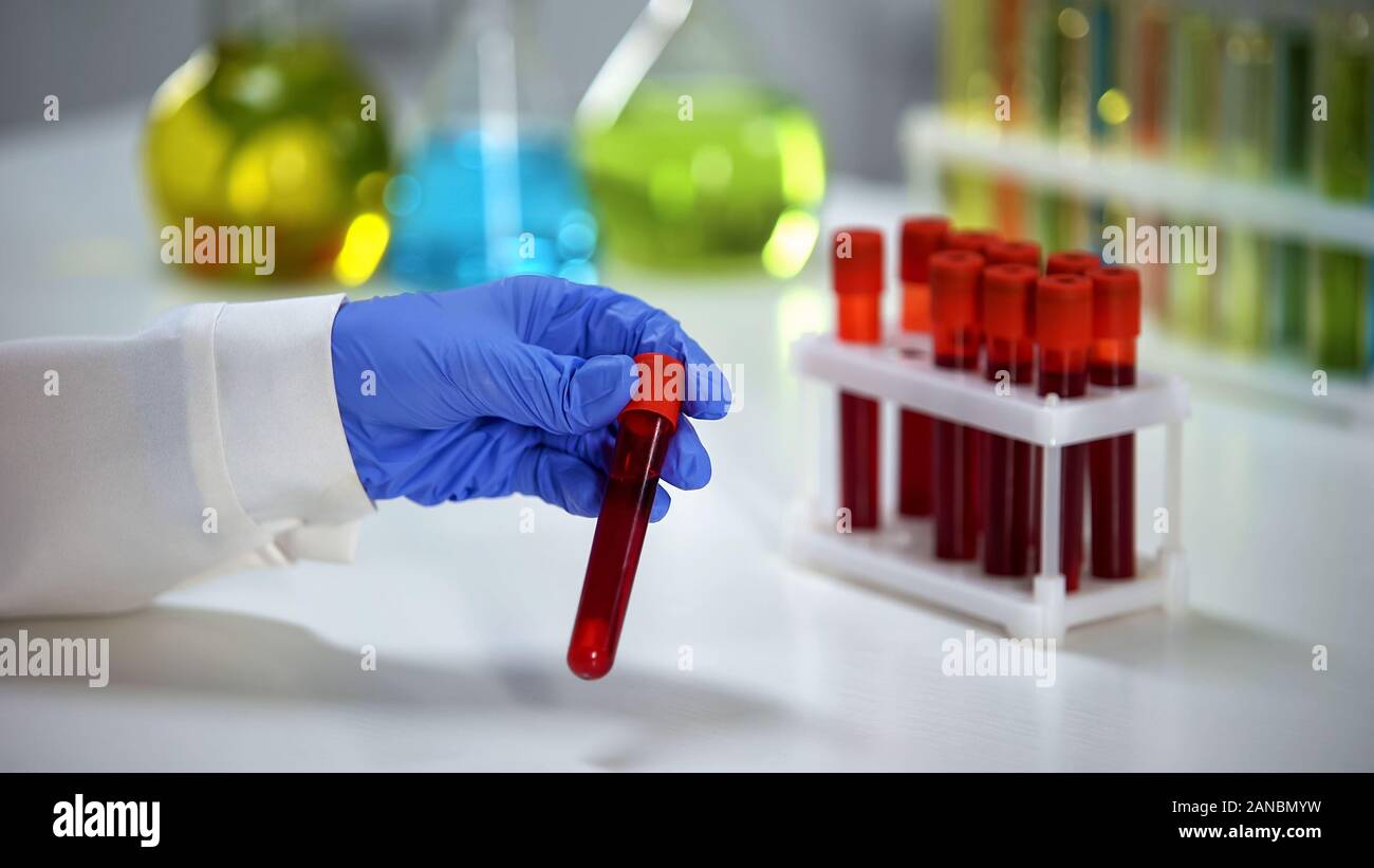 Blood serum hires stock photography and images Alamy
