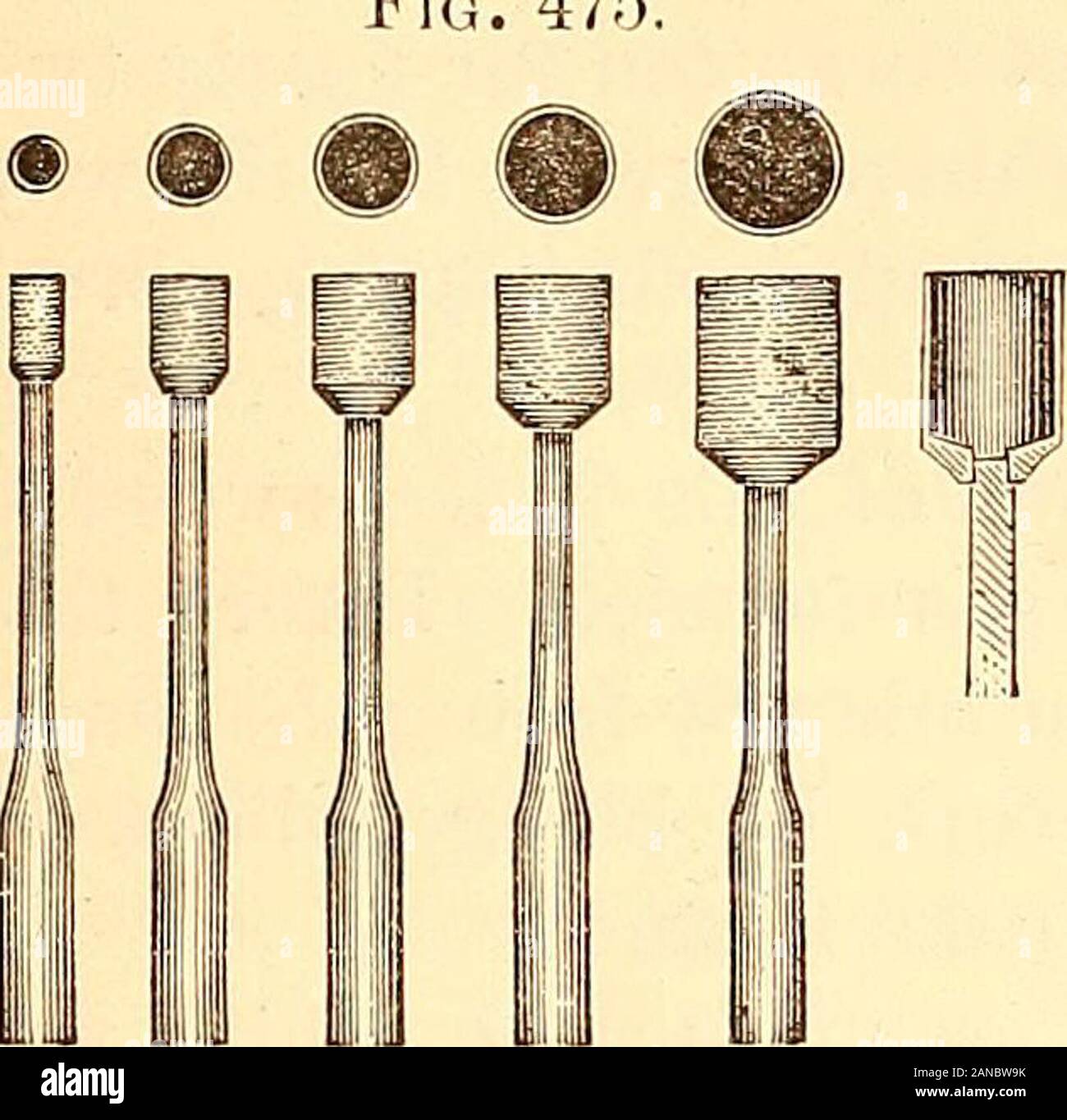 Principles and practice of operative dentistry . r. G. H. Weagant. which consistsof cutting inlays from artificial teeth or inlay rods (Fig. 474) by the aidof especially devised trephines of five different sizes (Fig. 475), made ofcopper and charged with diamond dust. These trephines are to be used in conjunction with Hows inlay burs(Fig. 476), which correspond in size to the trephines. After the decay has been removed from the cavity, a bur is selectedfrom the How set which will be large enough to include the utmost limitsof the cavity, and the final preparation of the cavity completed with i Stock Photo