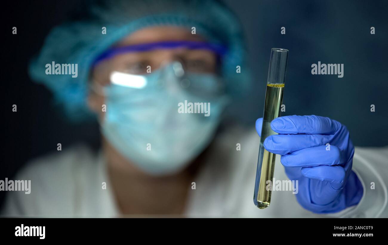 Lab worker holding test tube with urine sample, health check, medical