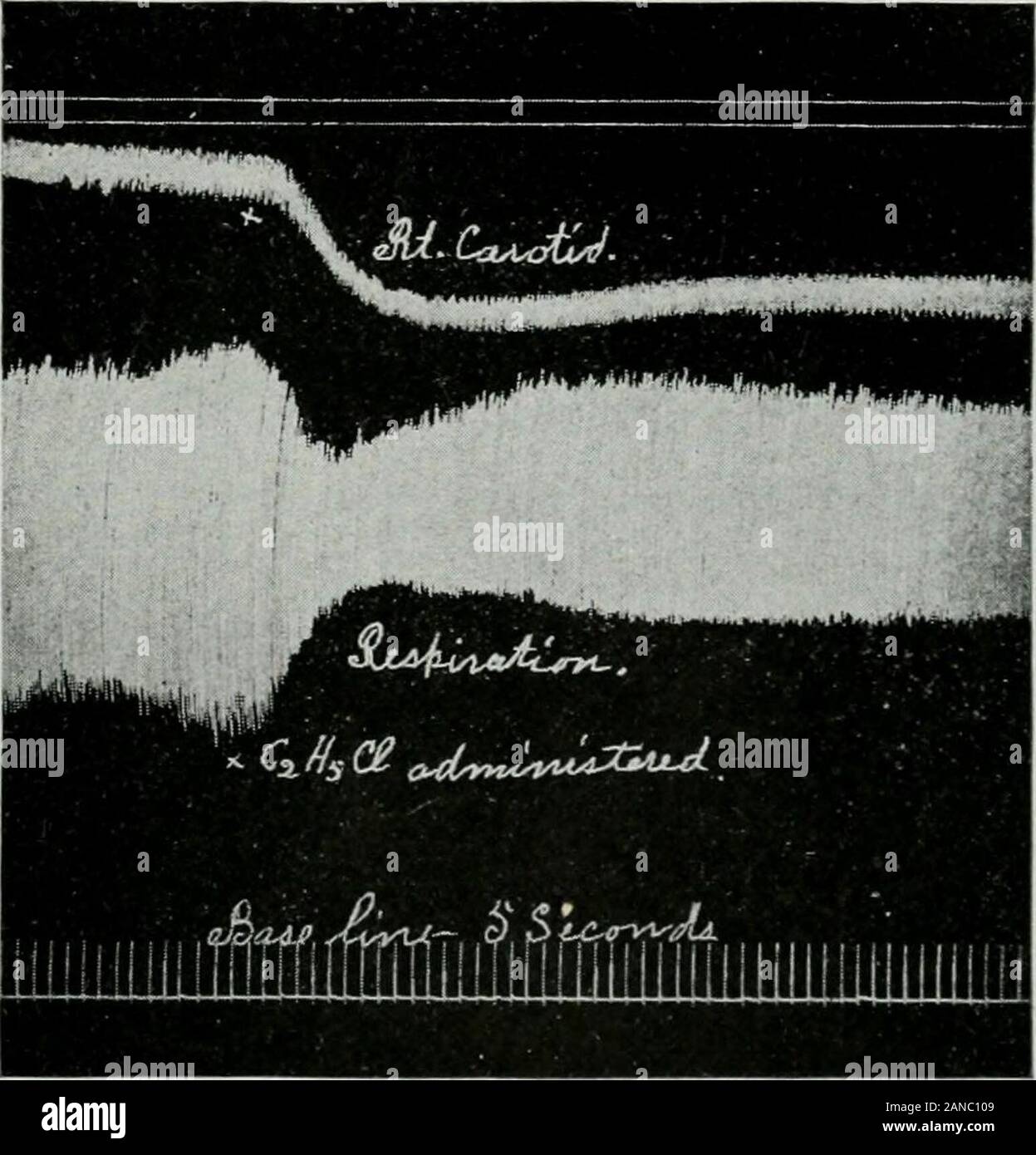 Nitrous oxide anesthesia hires stock photography and images Alamy